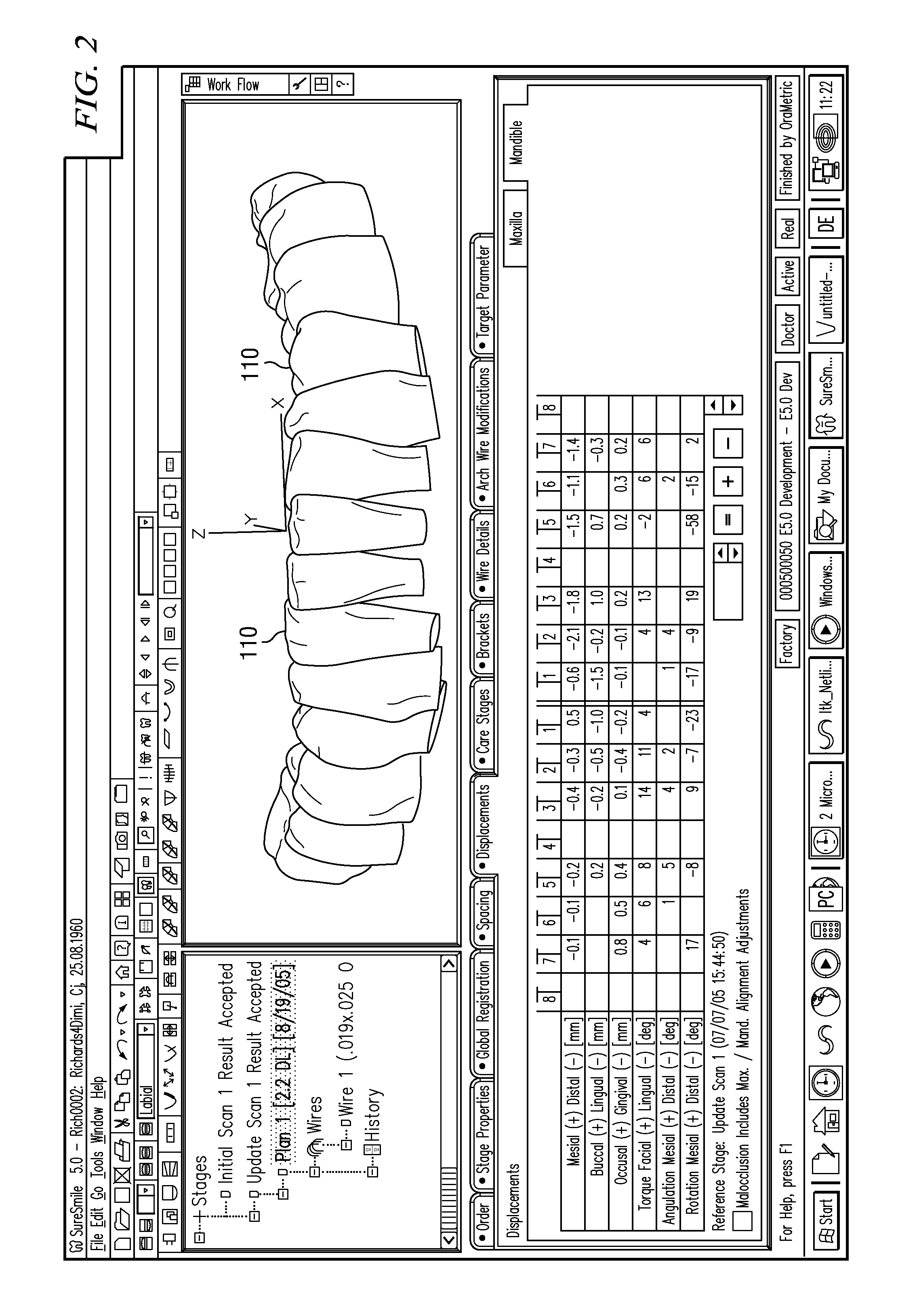 Method and apparatus for digitally evaluating insertion quality of customized orthodontic arch wire