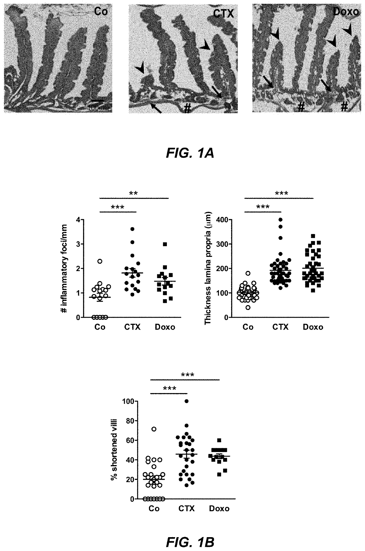 Microbiota composition, as a marker of responsiveness to chemotherapy, and use of microbial modulators (pre-, pro- or synbiotics) for improving the efficacy of a cancer treatment