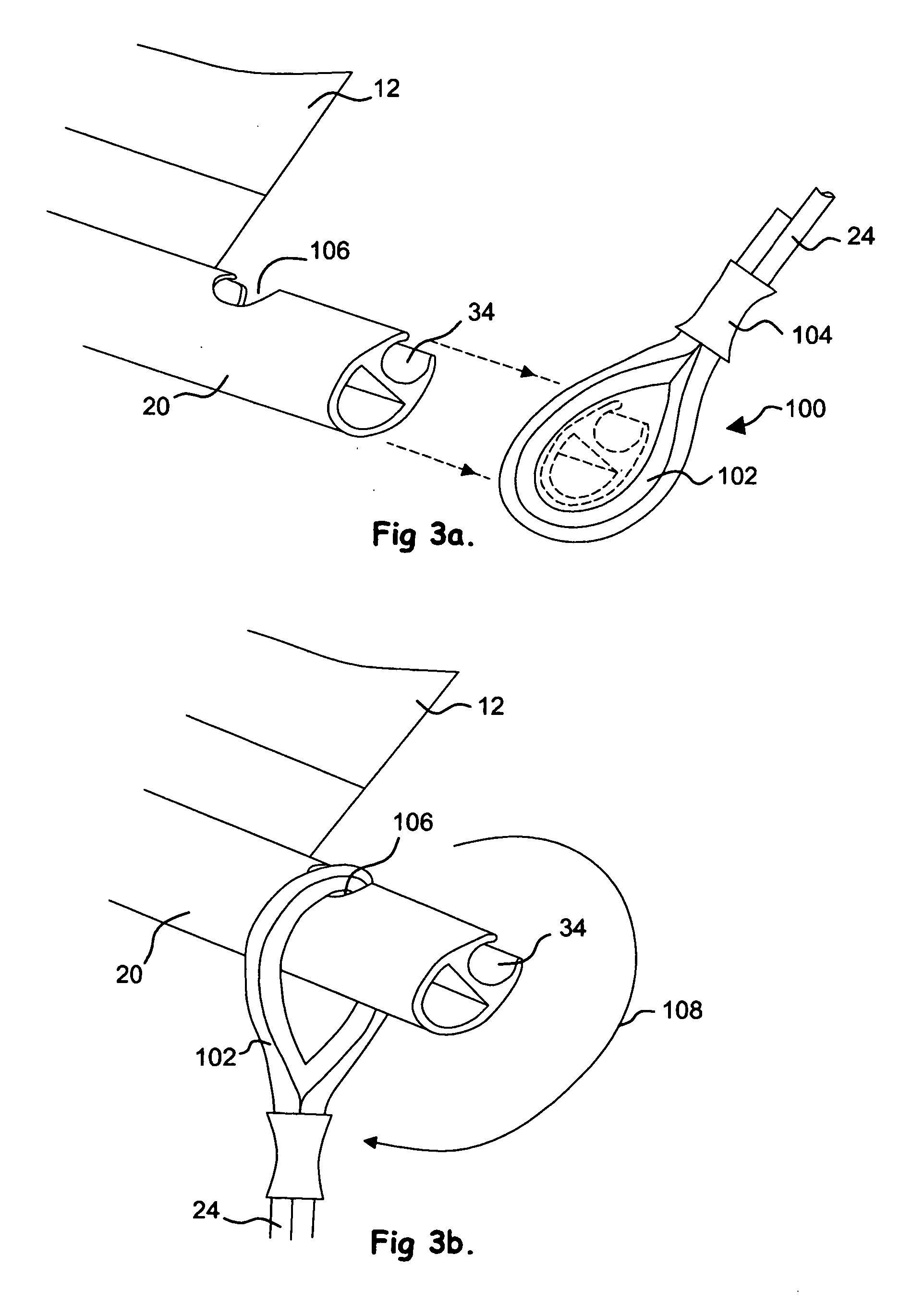 Storm protection apparatus