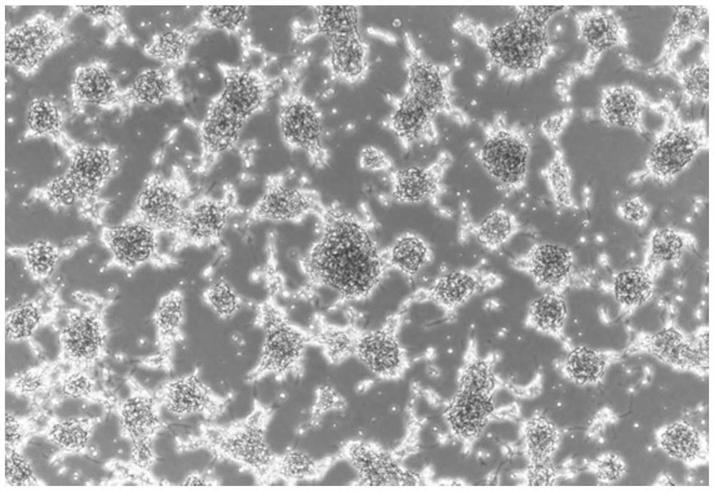 Method and culture medium for in-vitro isolated culture of glioma stem cells