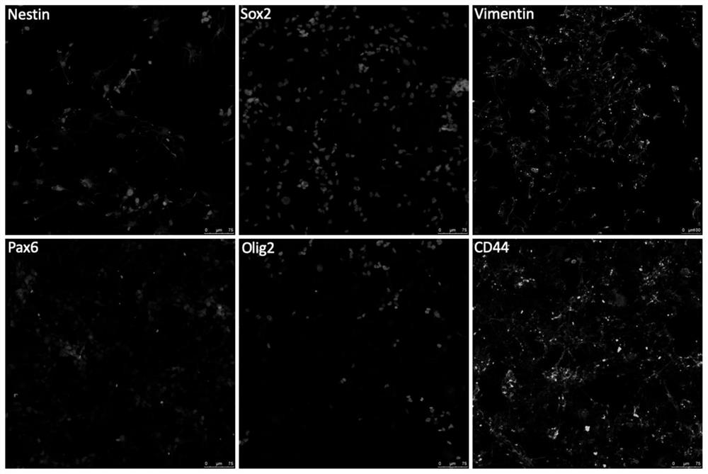 Method and culture medium for in-vitro isolated culture of glioma stem cells