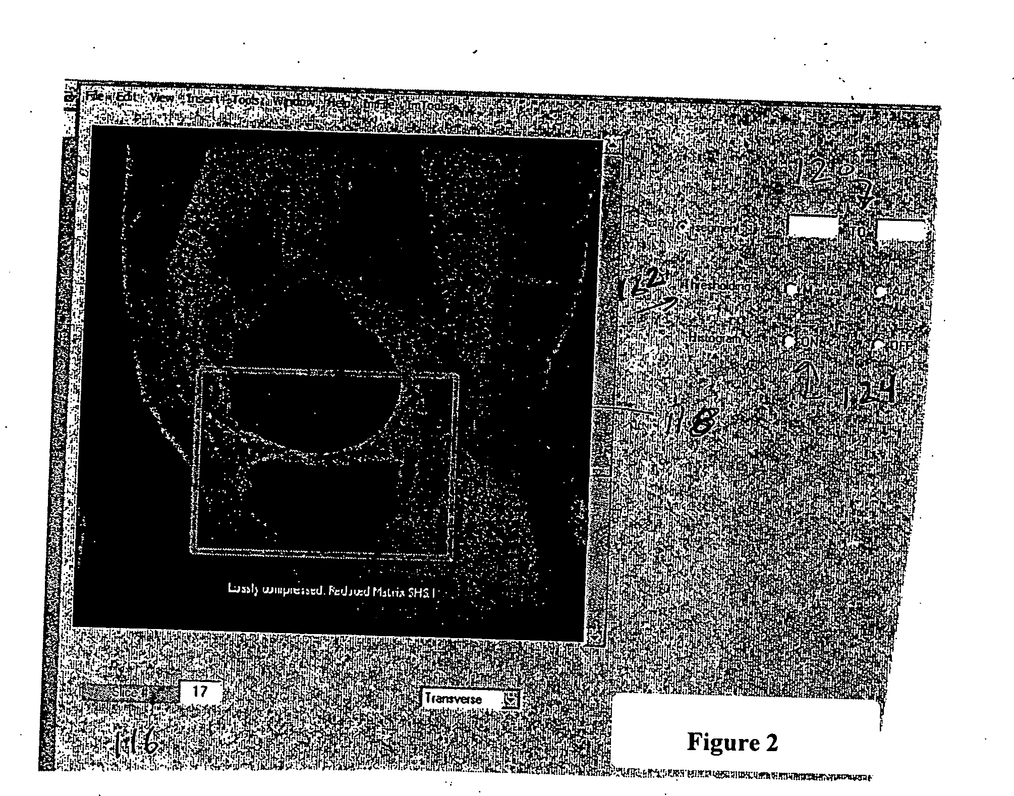 Radiographic imaging display apparatus and method