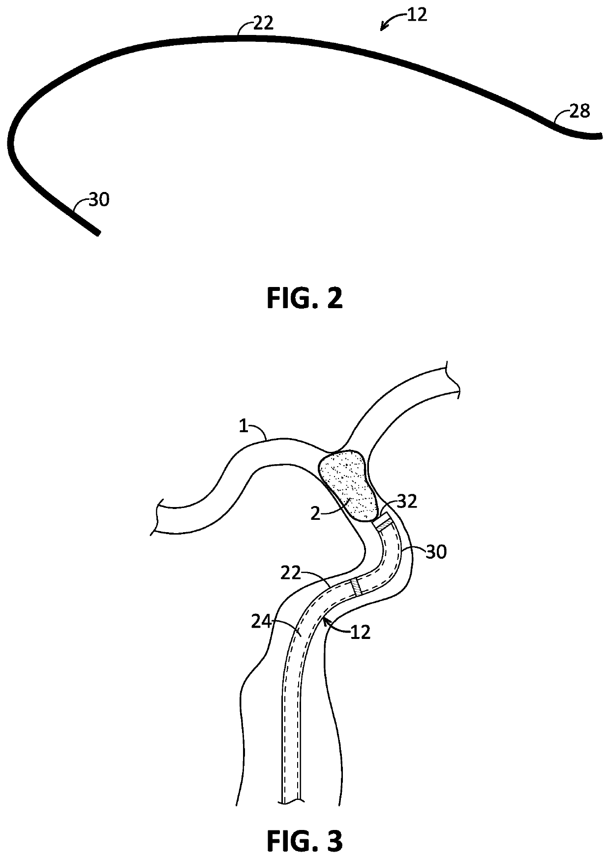 Mechanically resonant pulse relief valve and methods of use for assisted clearing of plugged aspiration