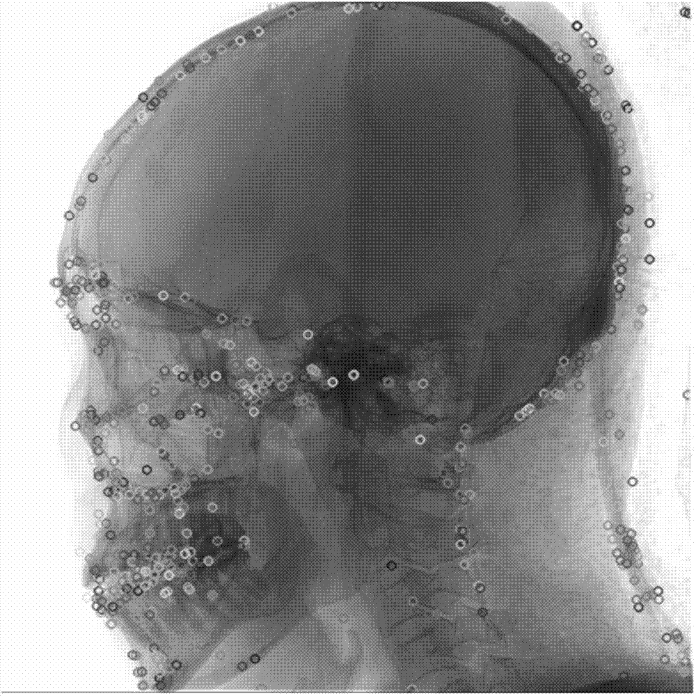 DSA (digital subtraction angiography) cerebrovascular image auto-segmenting method based on adjacent image feature point sets