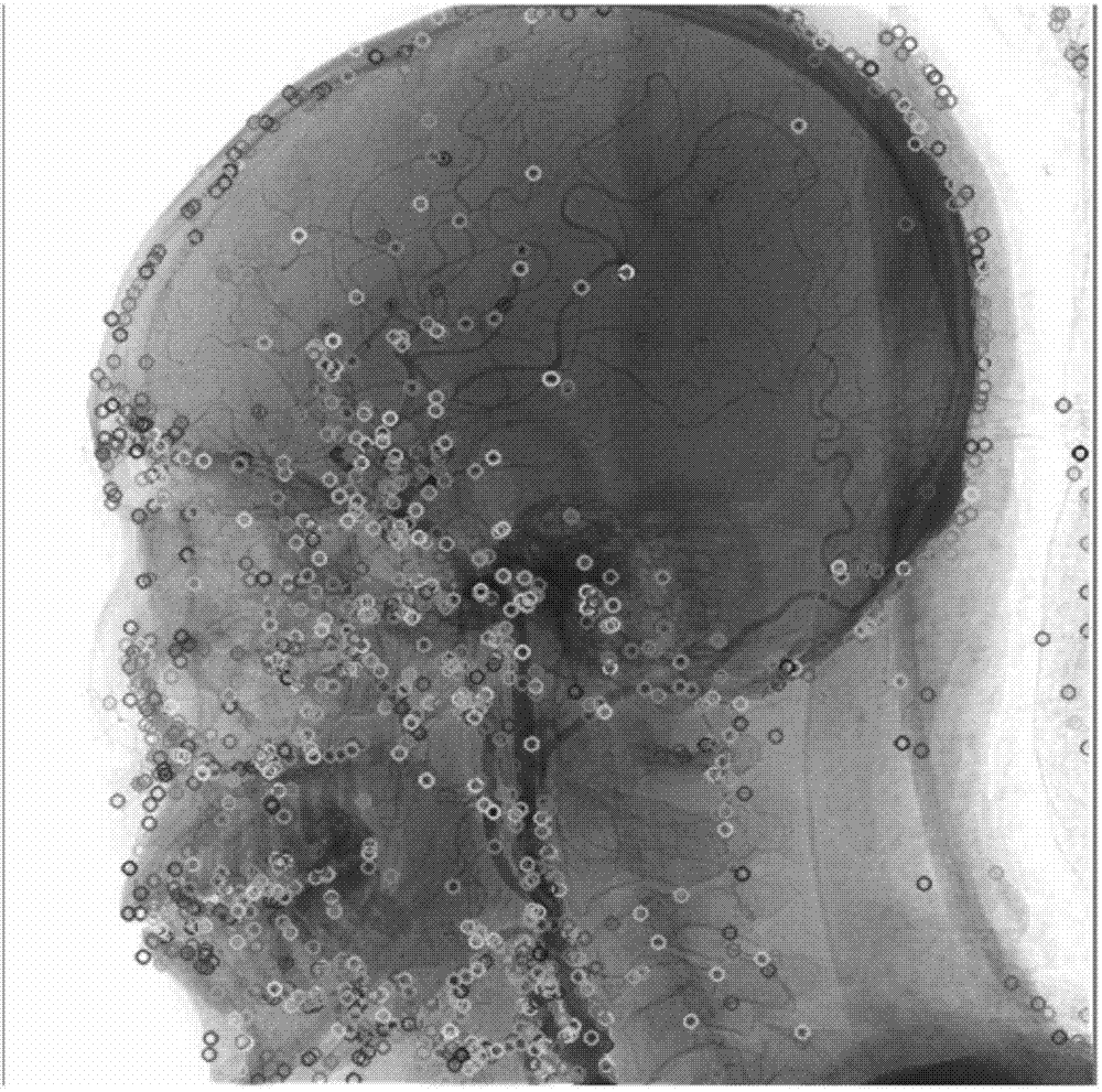 DSA (digital subtraction angiography) cerebrovascular image auto-segmenting method based on adjacent image feature point sets