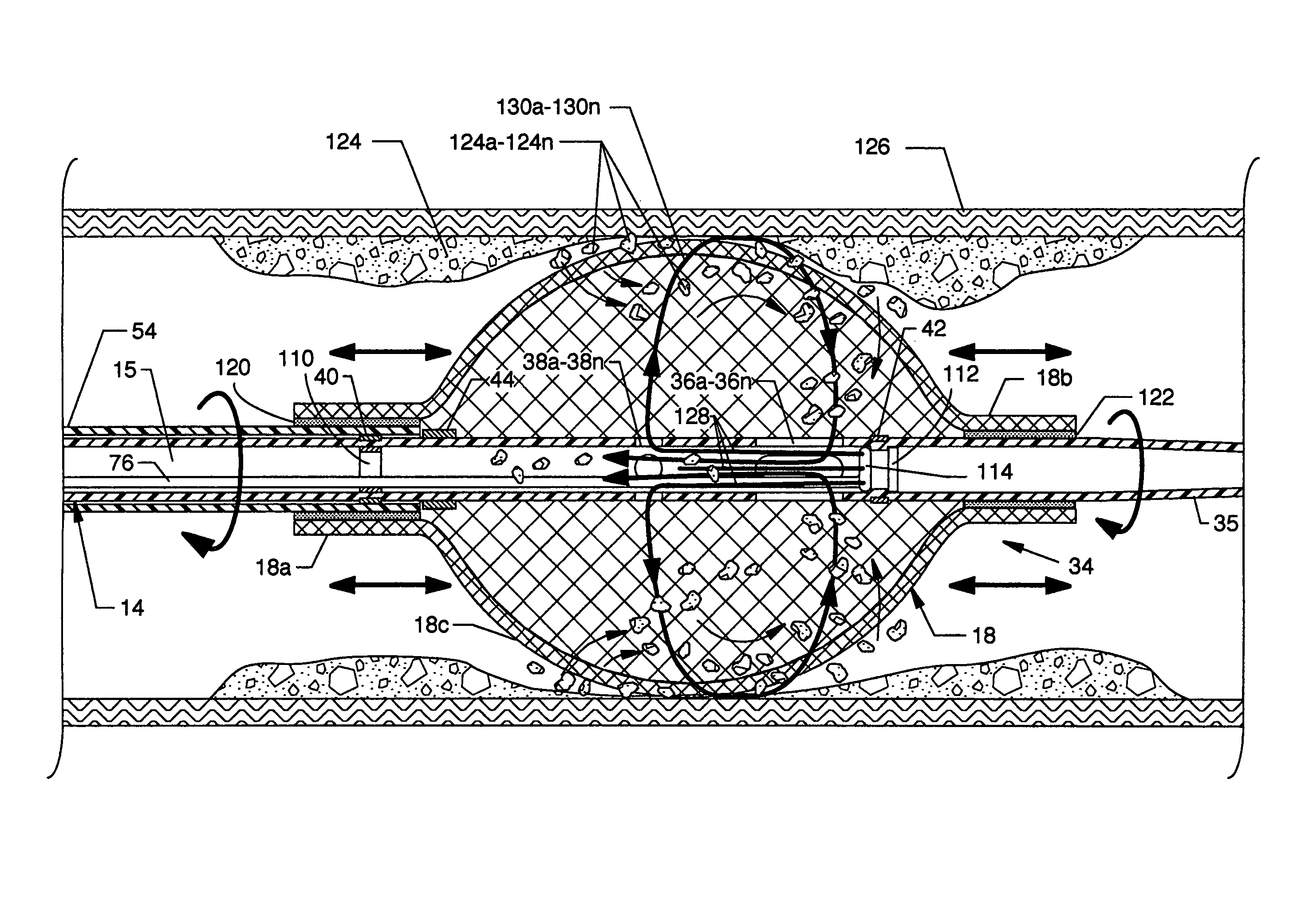 Cross stream thrombectomy catheter with flexible and expandable cage