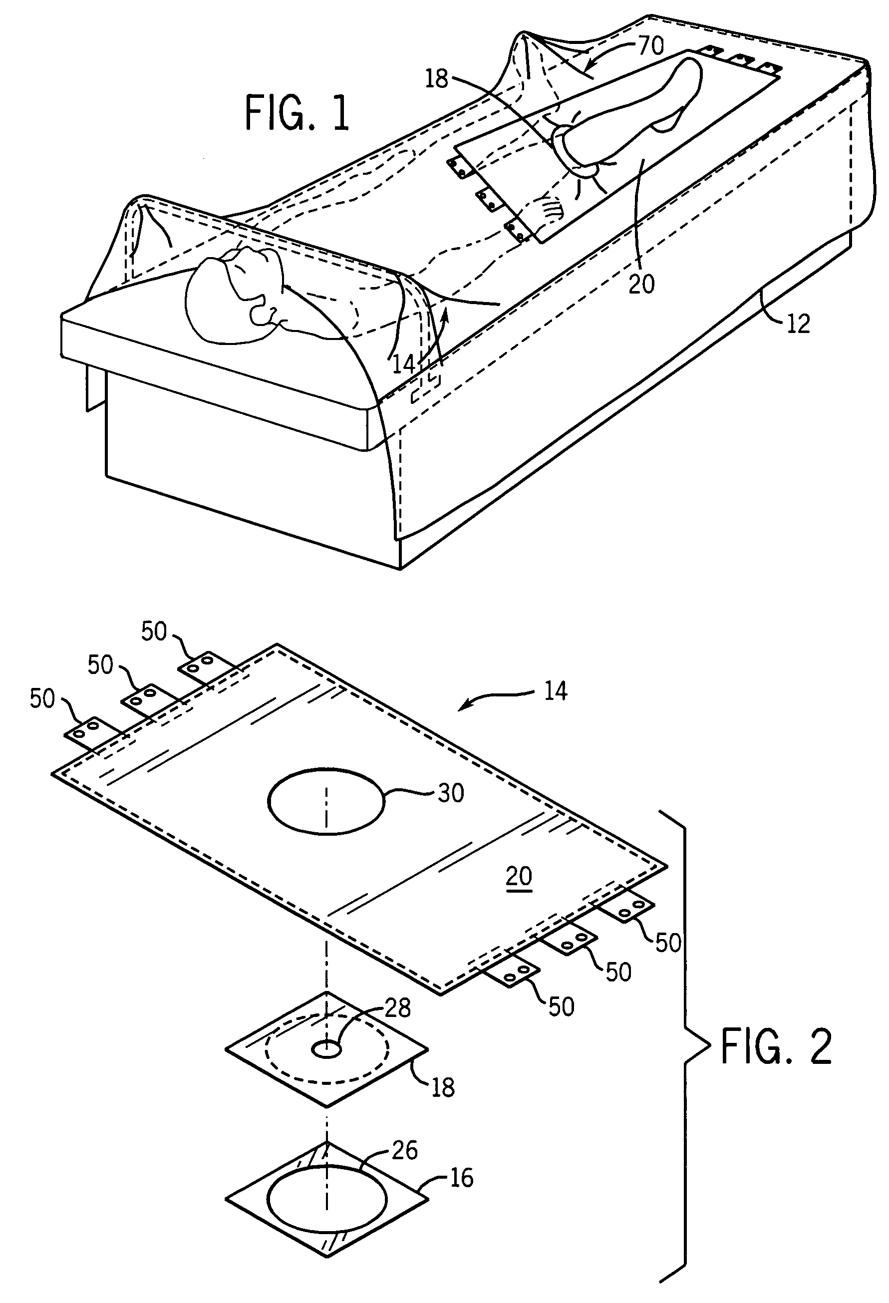 Fenestrated extremity surgical drape