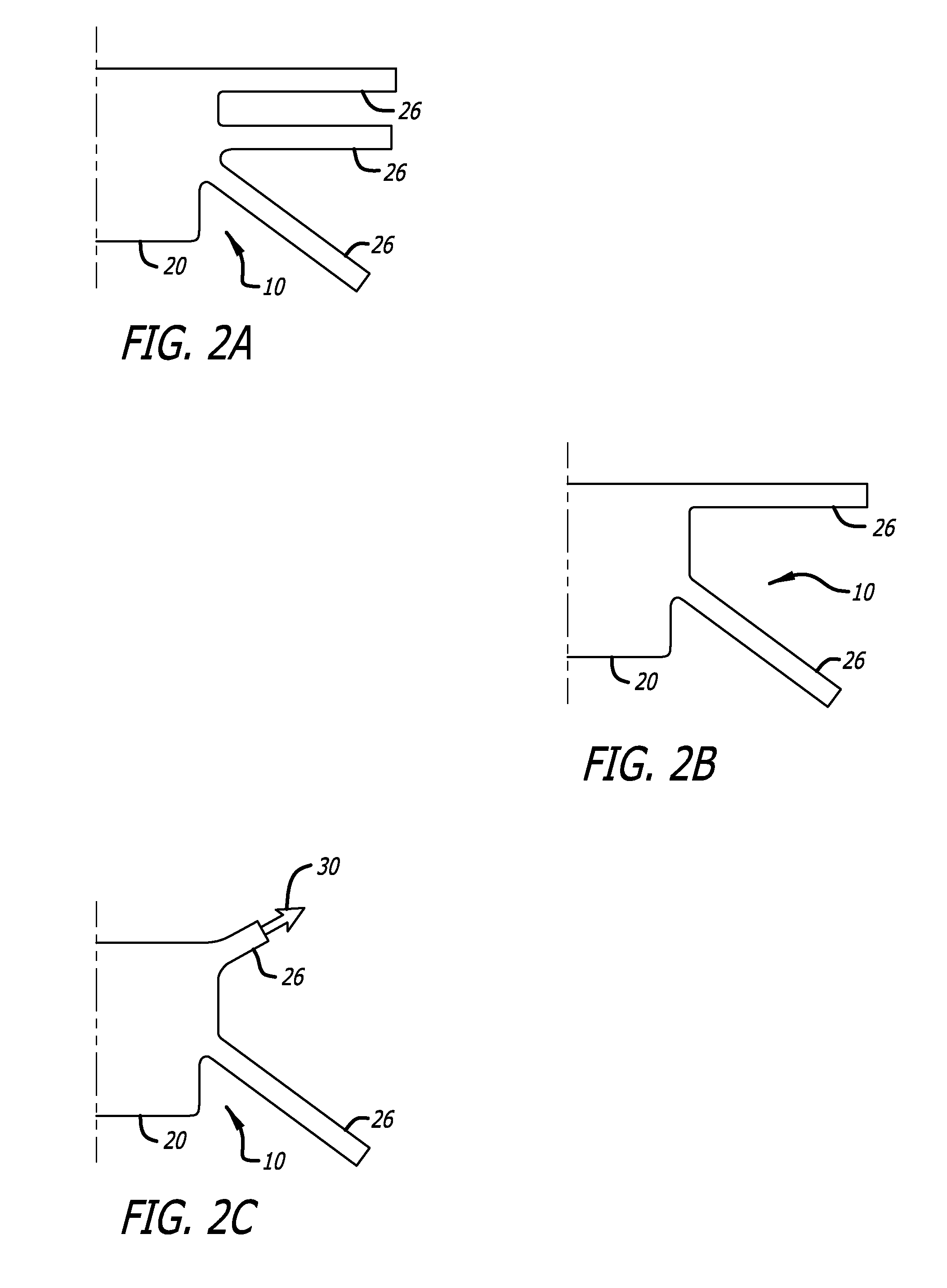 Implants And Procedures For Supporting Anatomical Structures For Treating Conditions Such As Pelvic Organ Prolapse