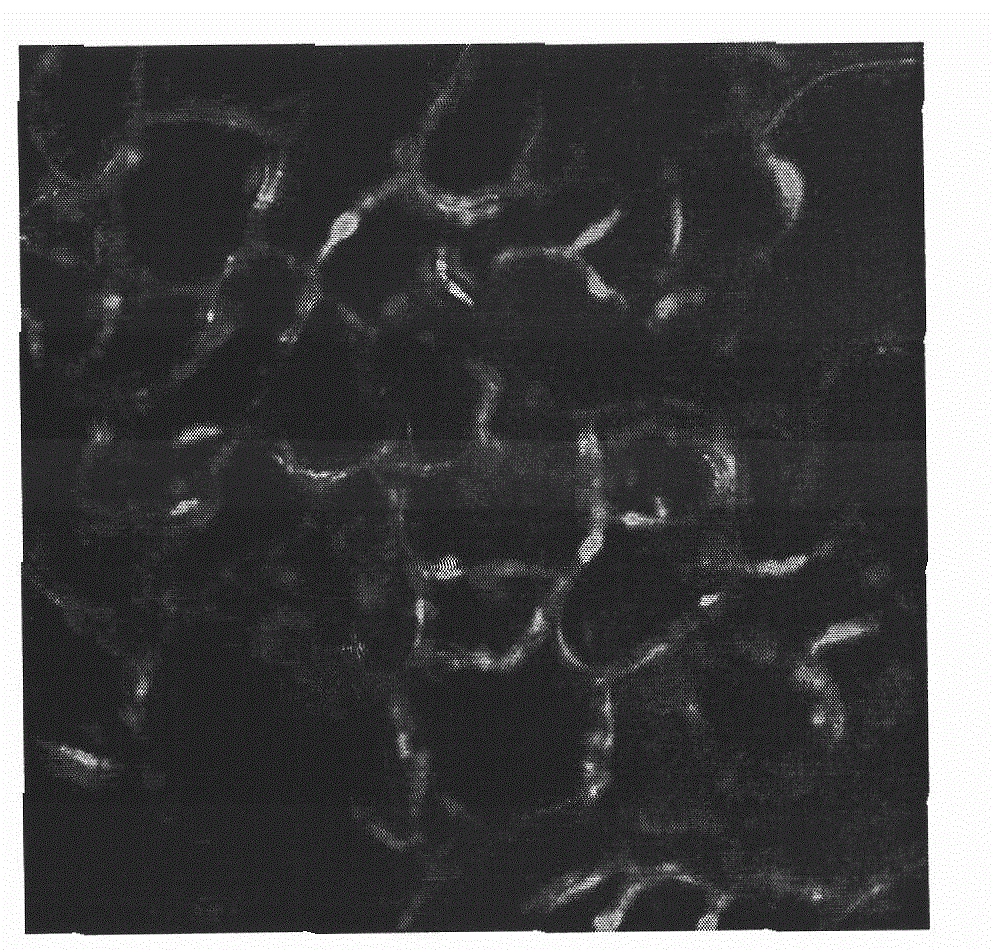 II type collagen sponge bracket and uses thereof