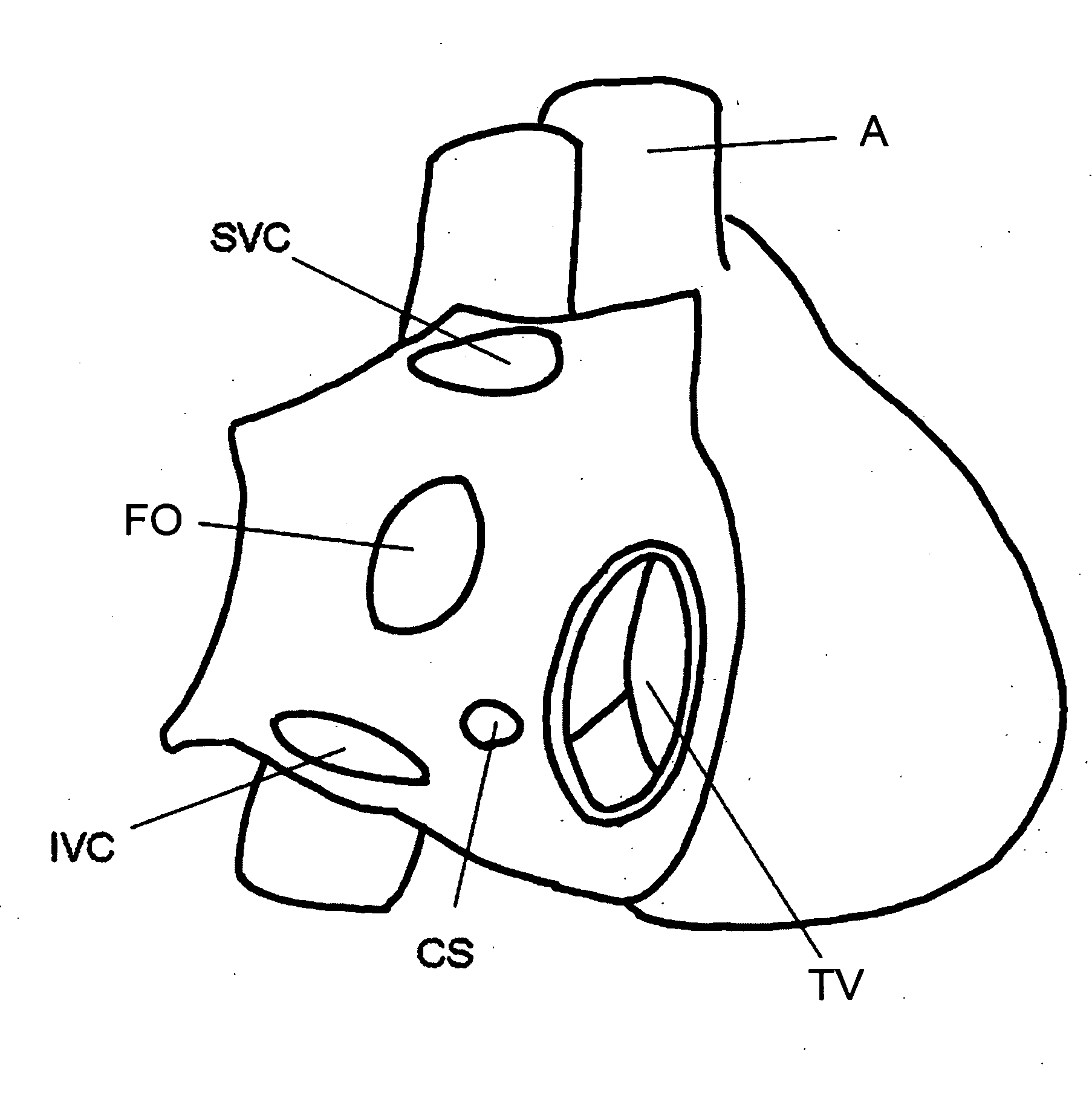 Methods and devices for image-guided manipulation or sensing of anatomic structures