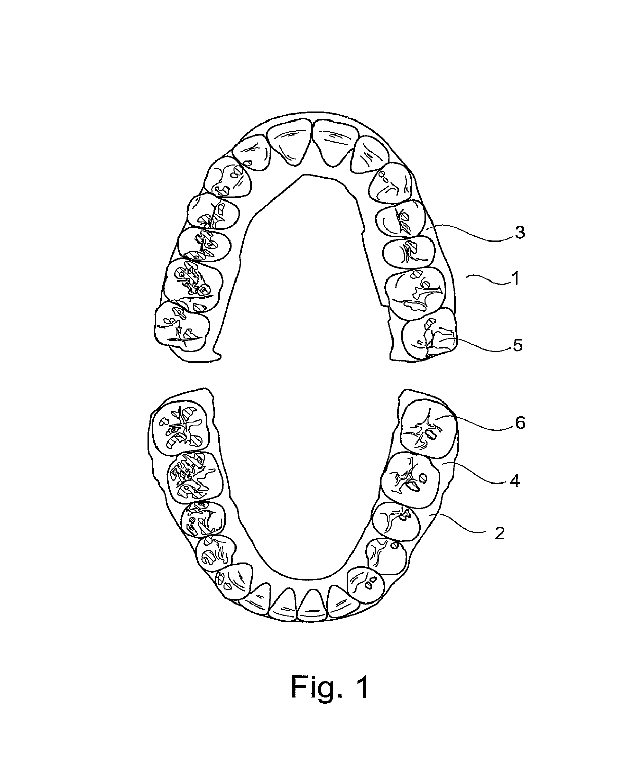 Method for constructing tooth surfaces of a dental prosthesis and for producing dental restorations