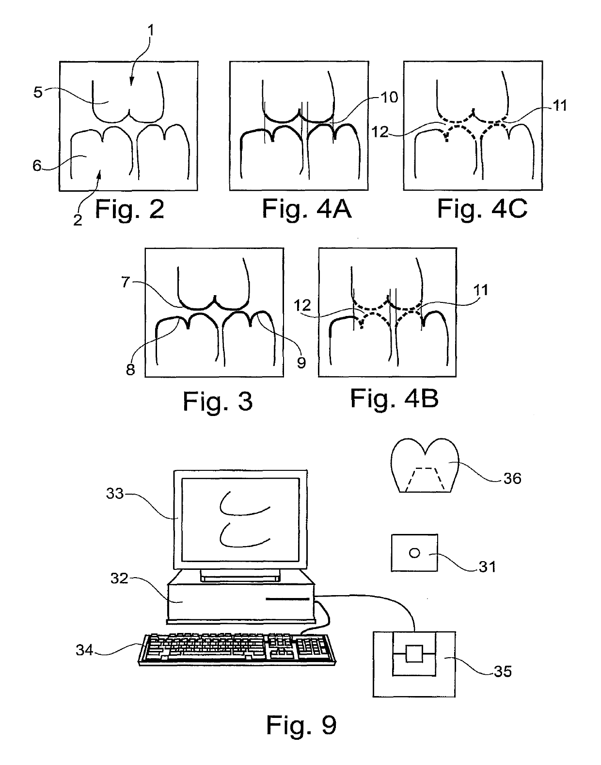 Method for constructing tooth surfaces of a dental prosthesis and for producing dental restorations