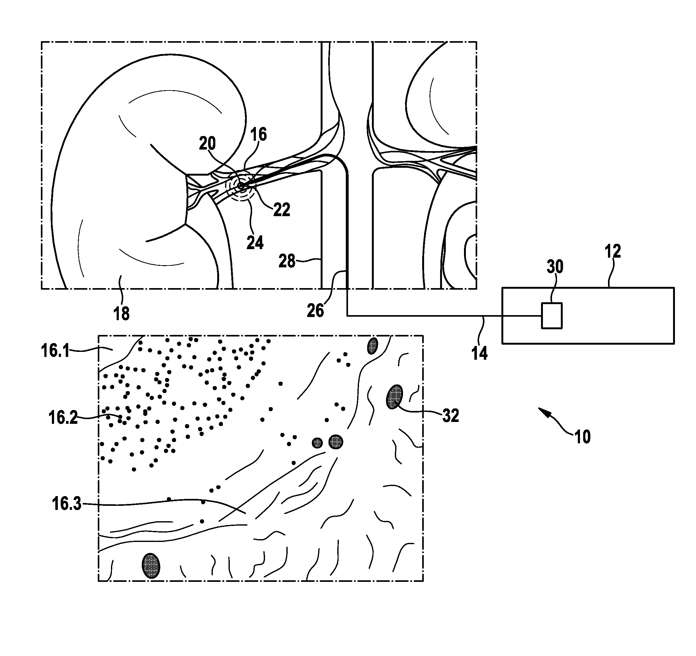 Medical device for evaluating a temperature signal