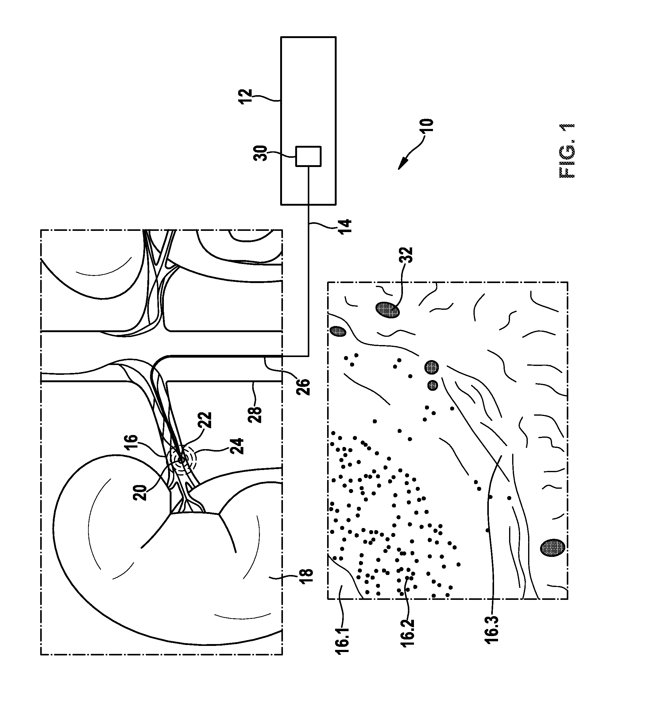 Medical device for evaluating a temperature signal