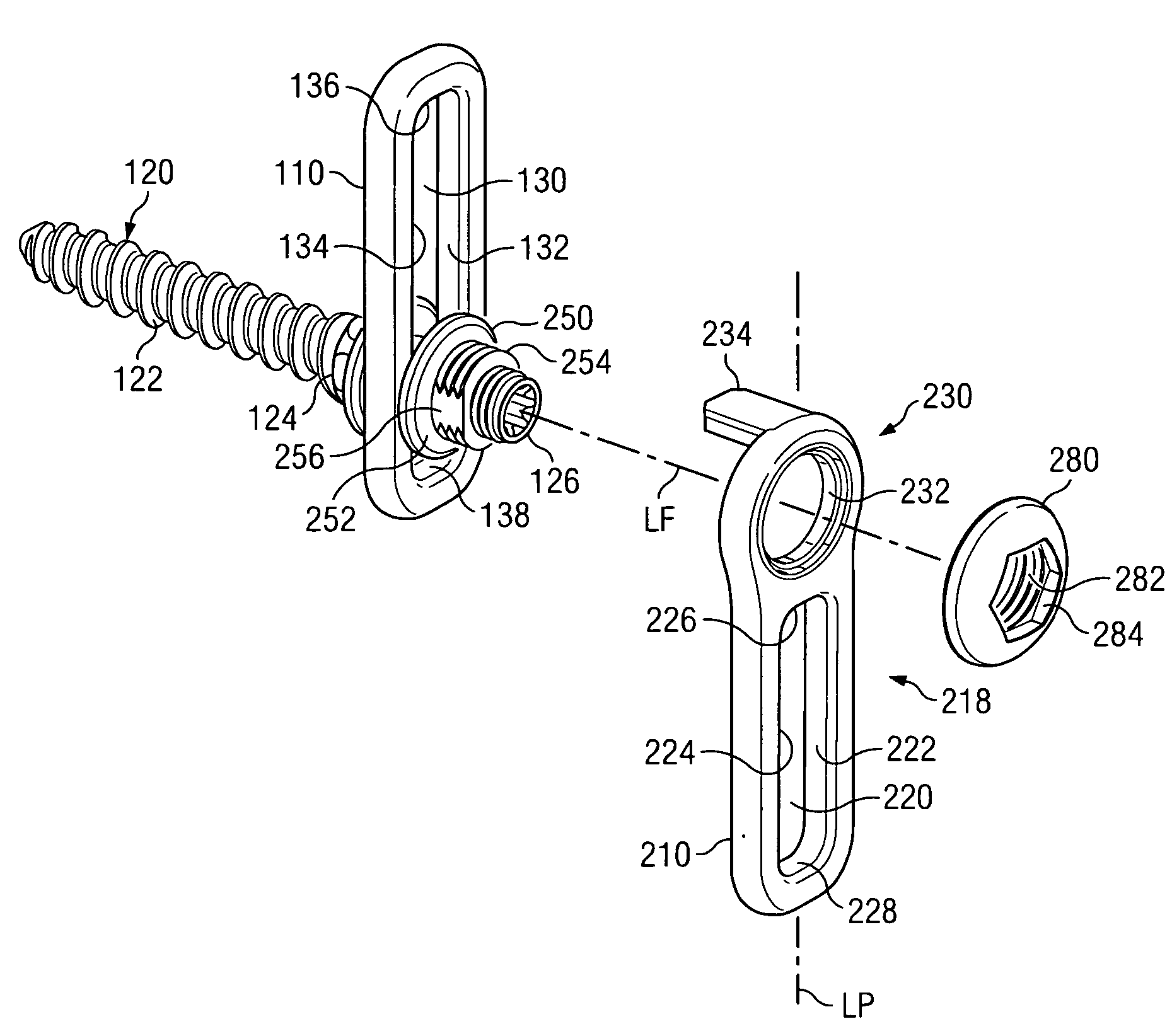 Revision fixation plate and method of use