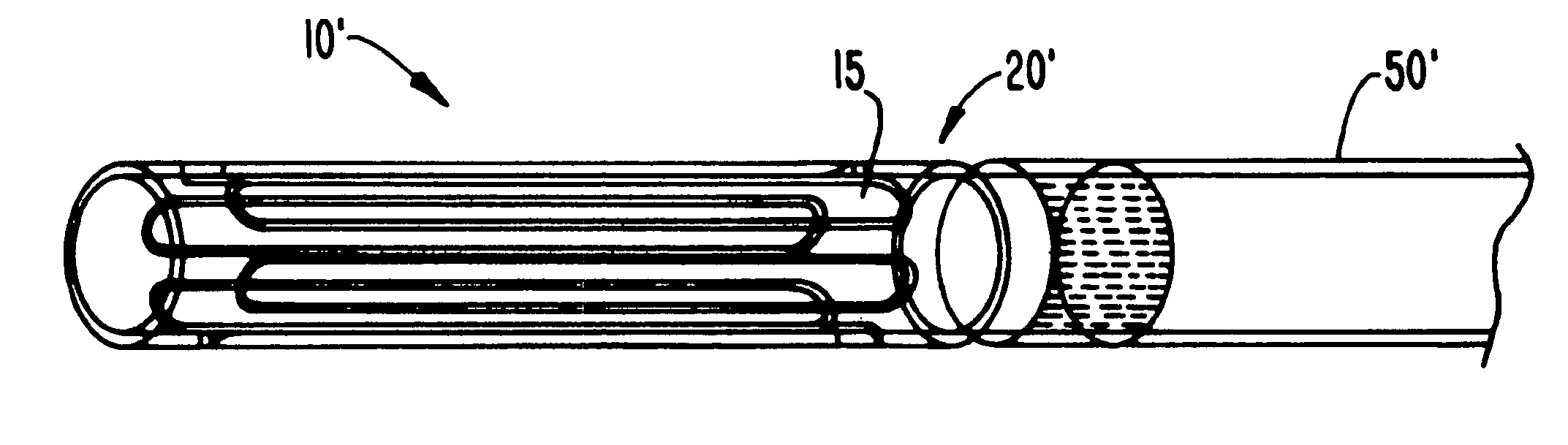 Selectively-expandable bone scaffold