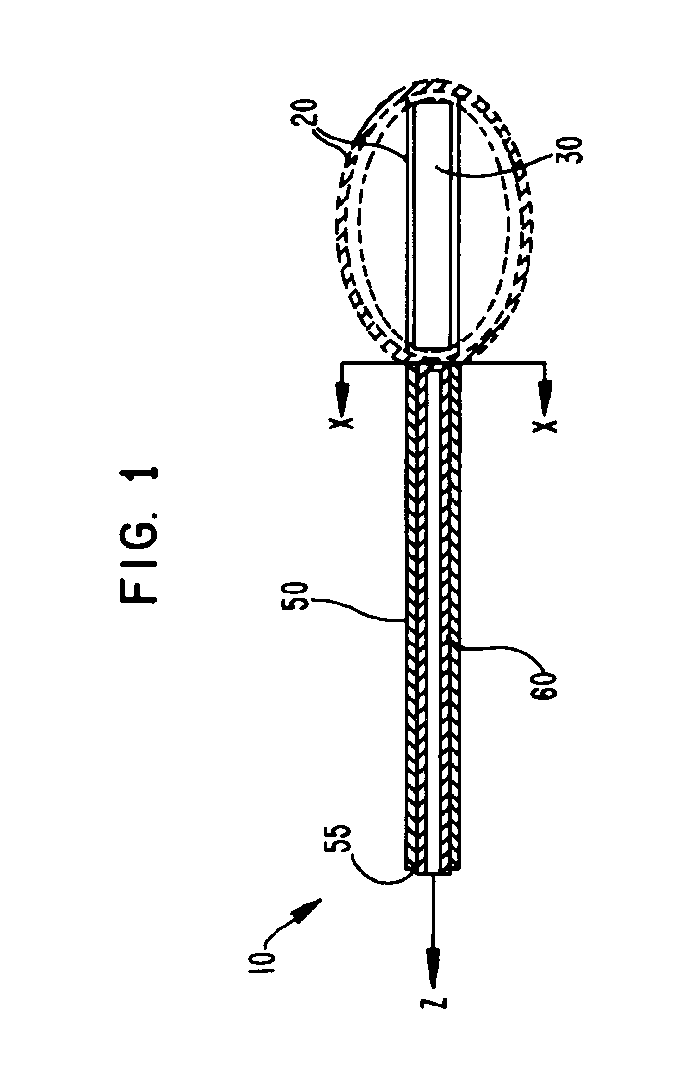 Selectively-expandable bone scaffold