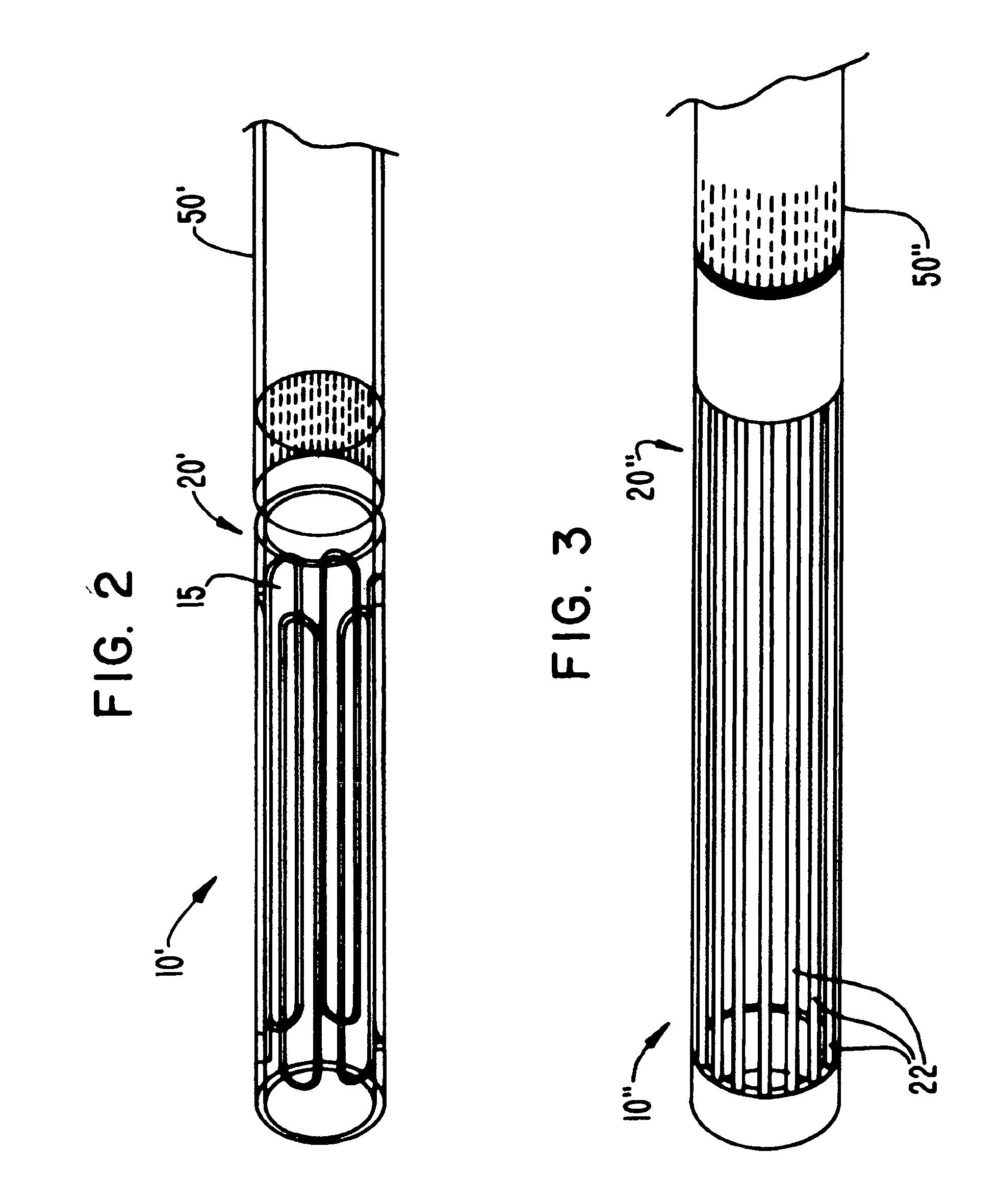 Selectively-expandable bone scaffold