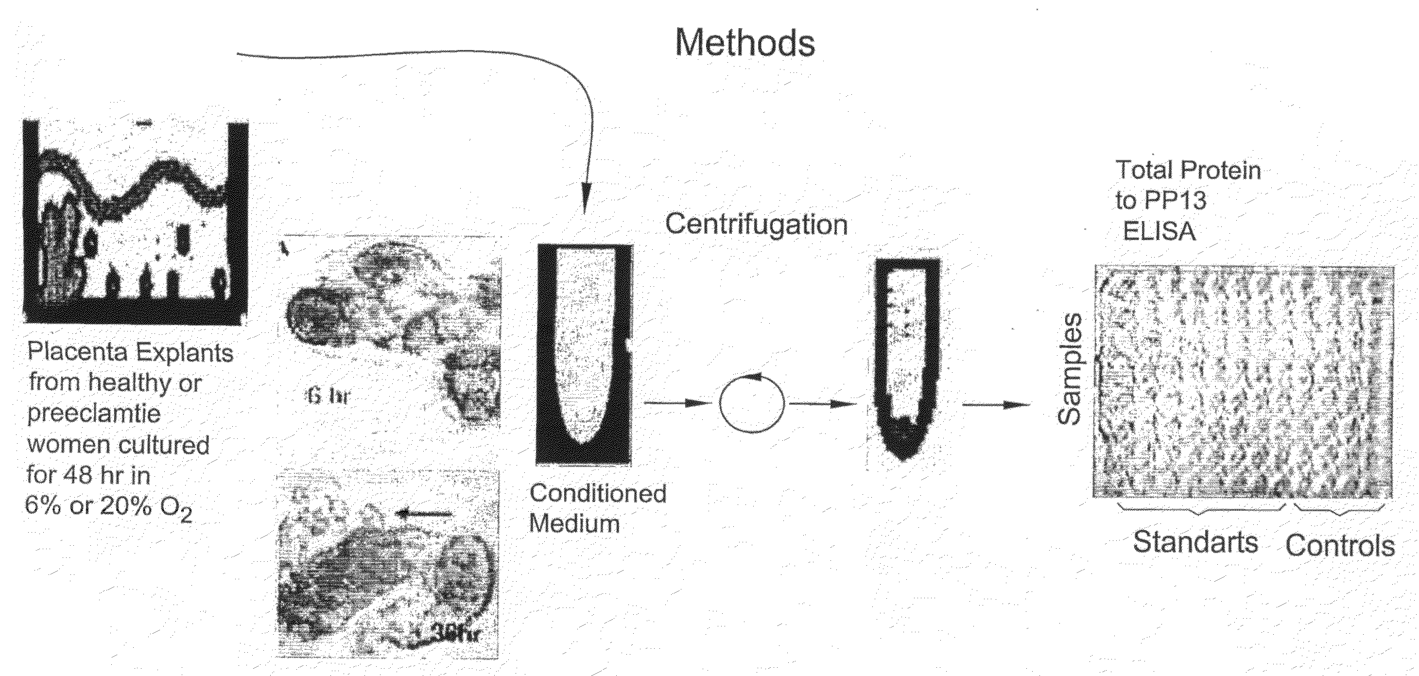 Method for Determining the Effectiveness of a Treatment for Preeclampsia