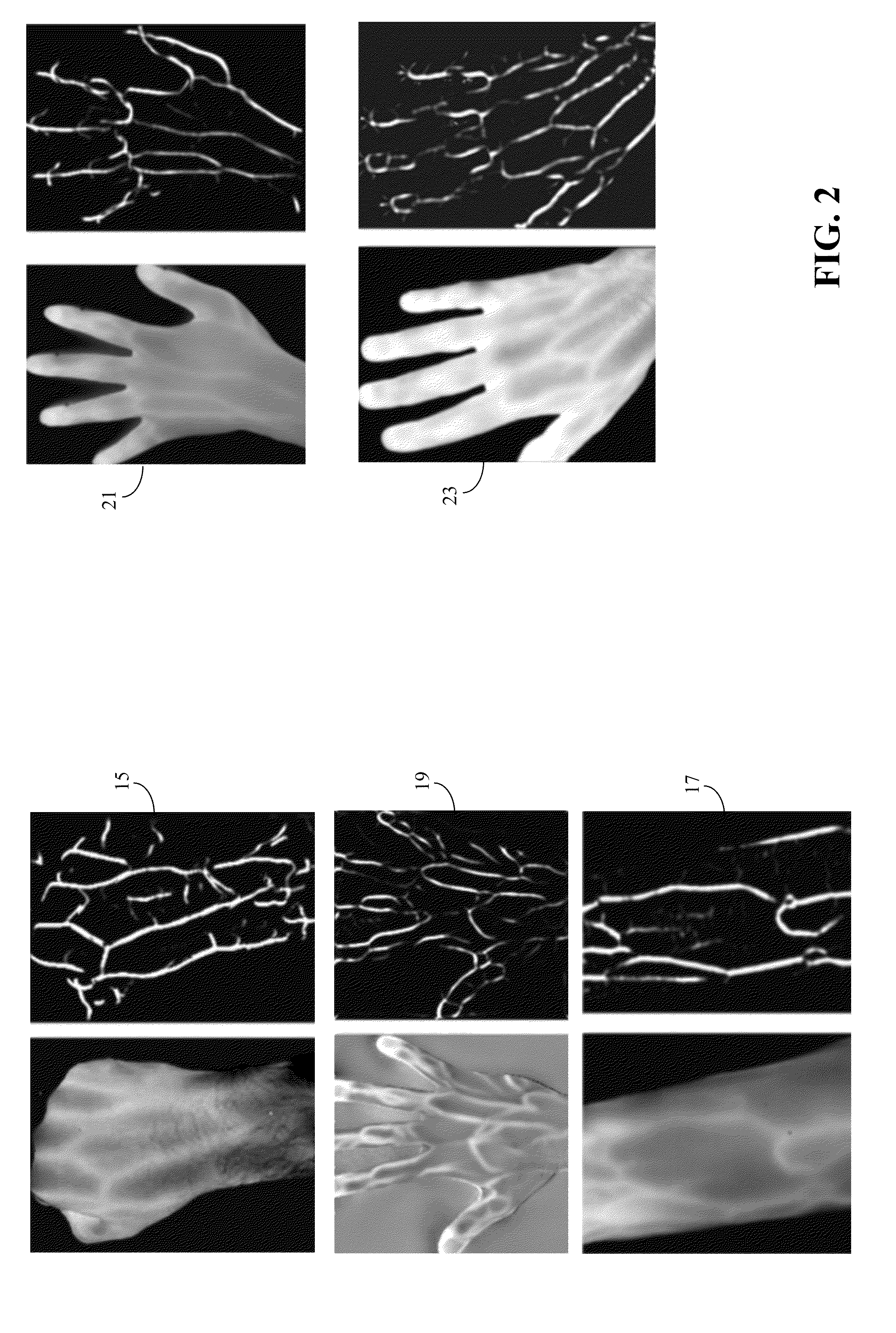 Fast and Robust Classification Algorithm for Vein Recognition Using Infrared Images