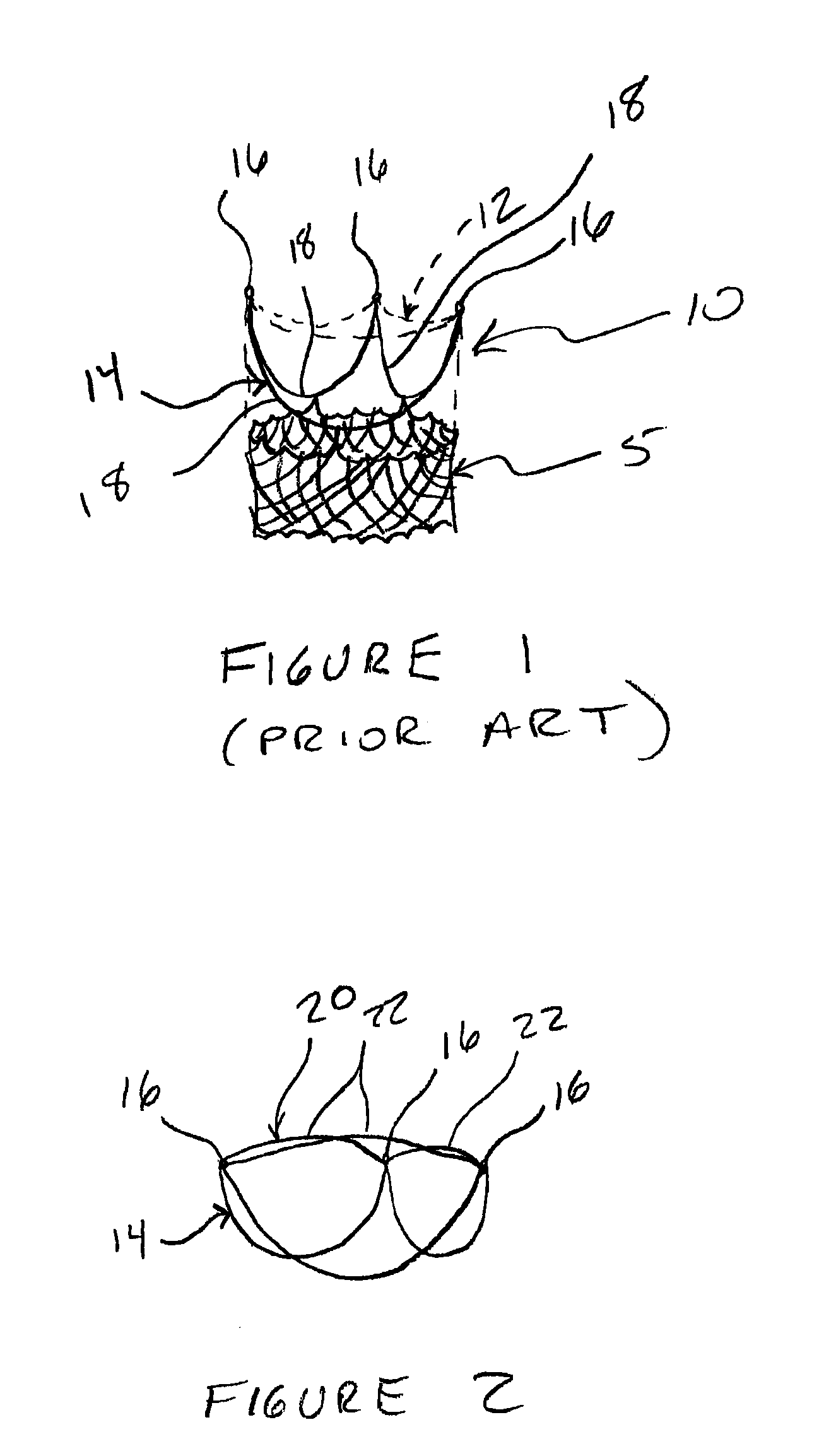 Reinforced commissural support structure