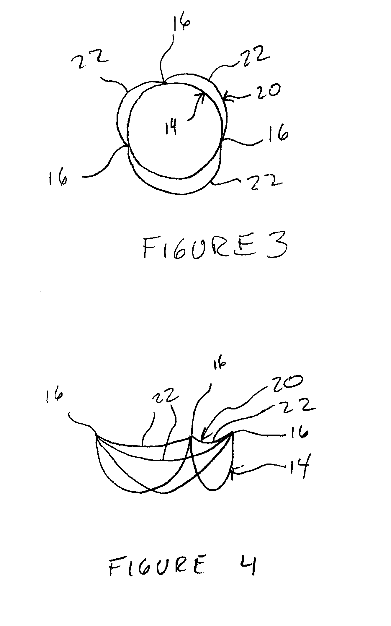 Reinforced commissural support structure