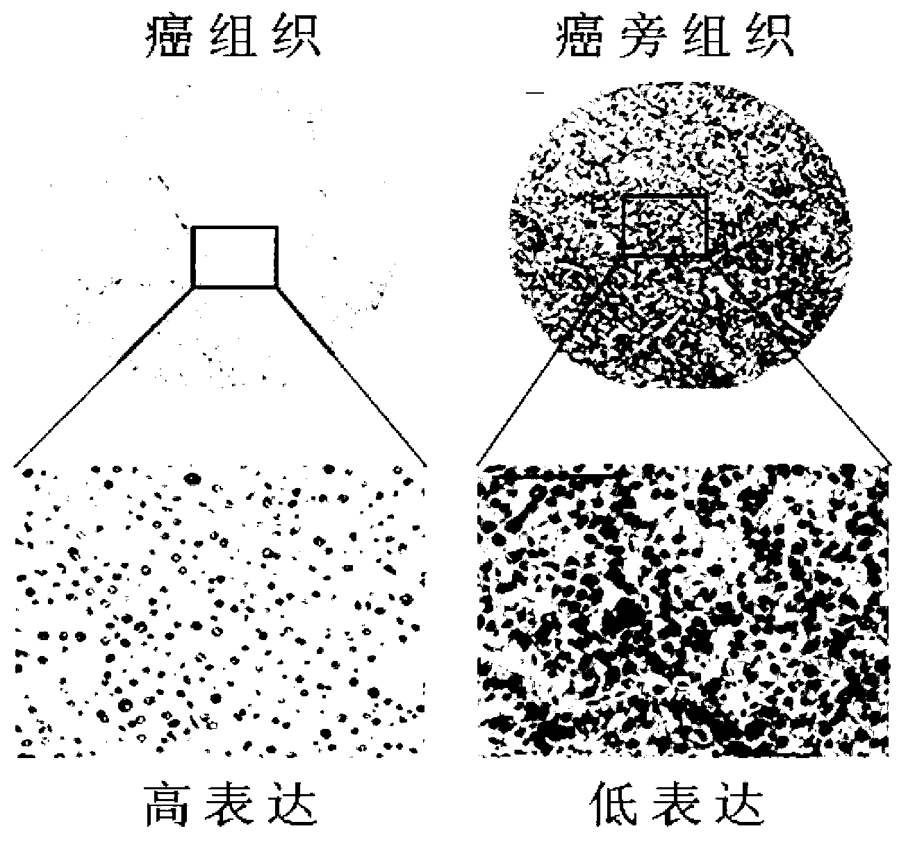 Application of Shp2 protein in preparation of liver cancer prognosis evaluation kit