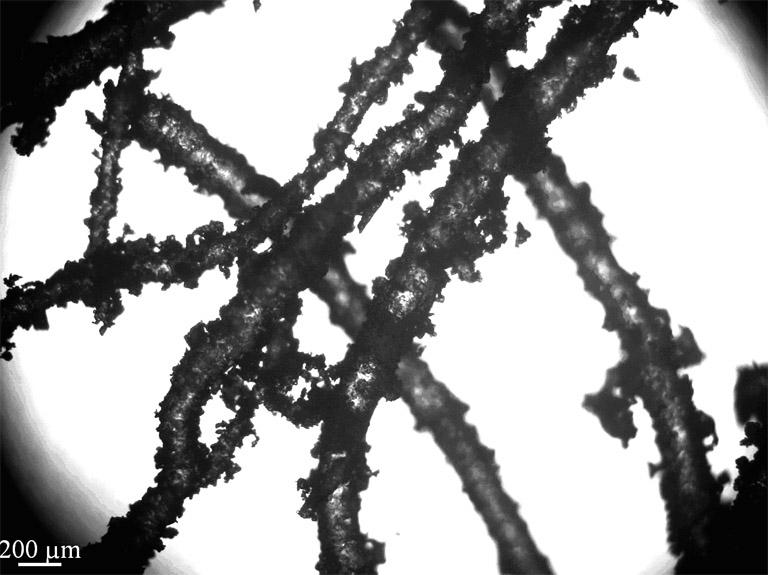 Porous stent with network passage and preparation method of porous stent