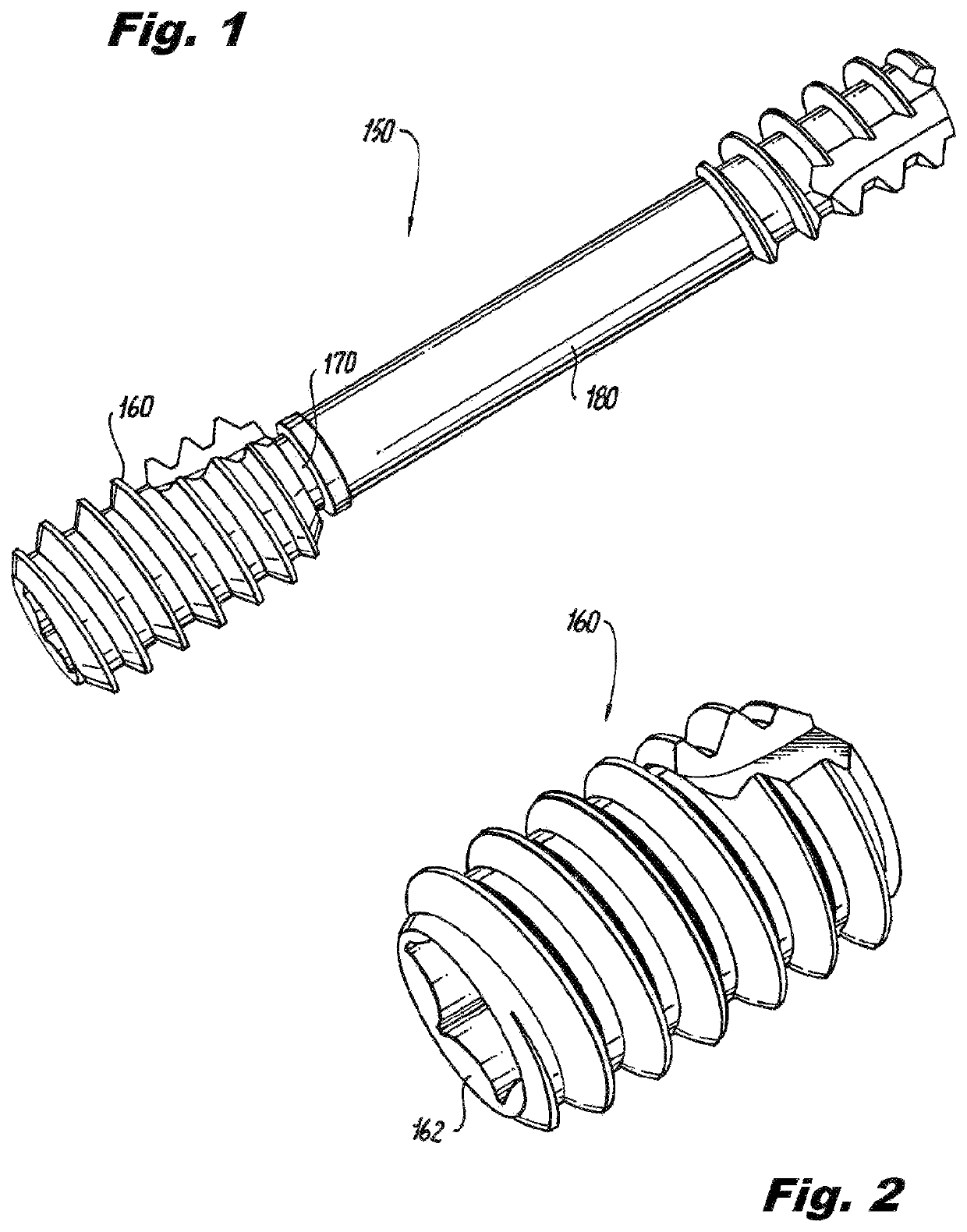 Methods, instruments and implants for scapho-lunate reconstruction