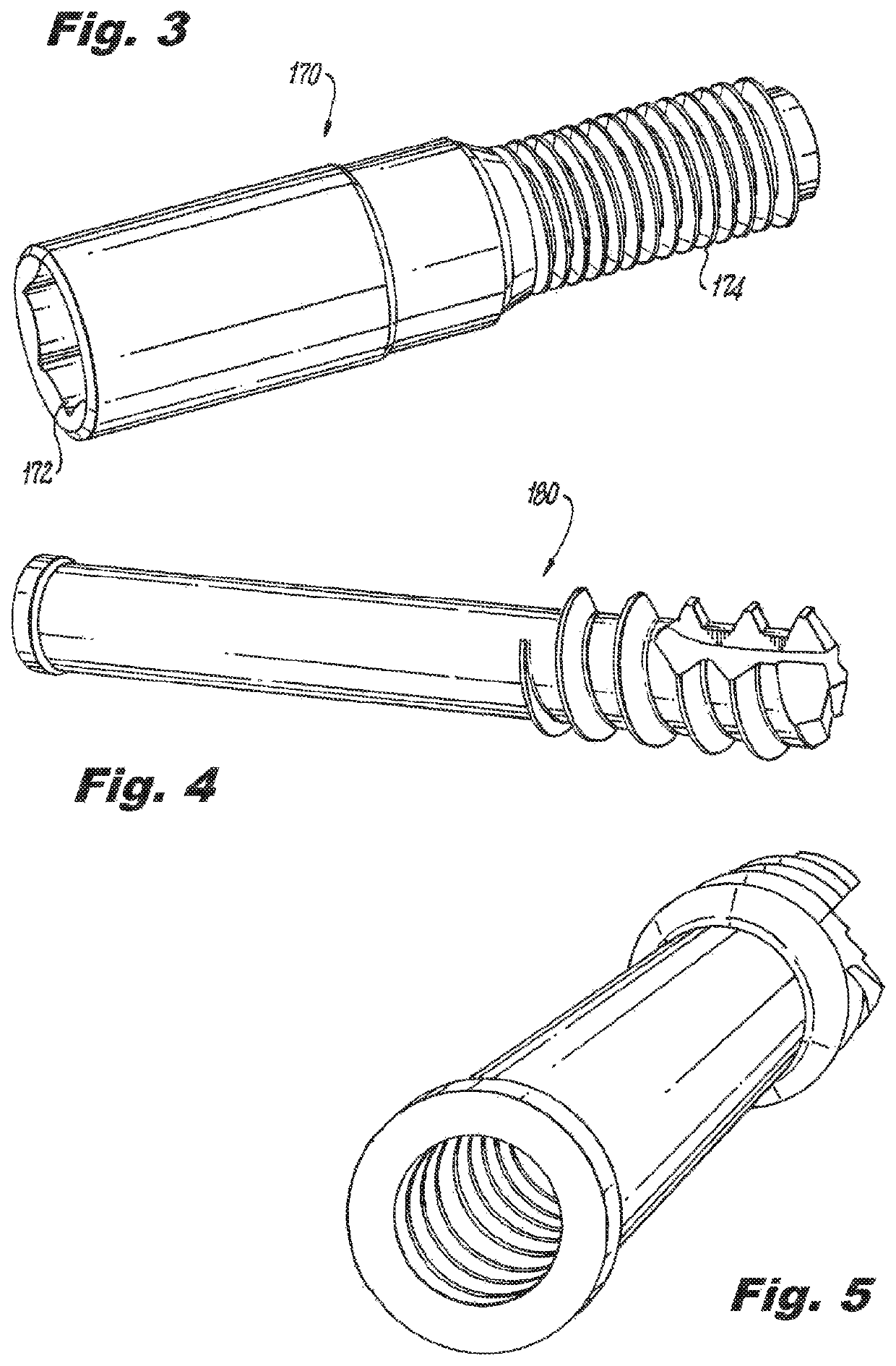 Methods, instruments and implants for scapho-lunate reconstruction