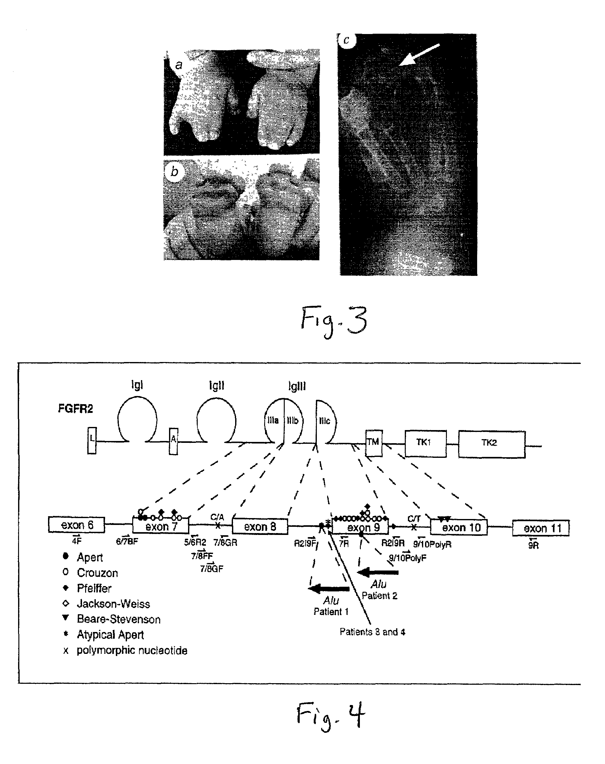 Splice choice antagonists as therapeutic agents