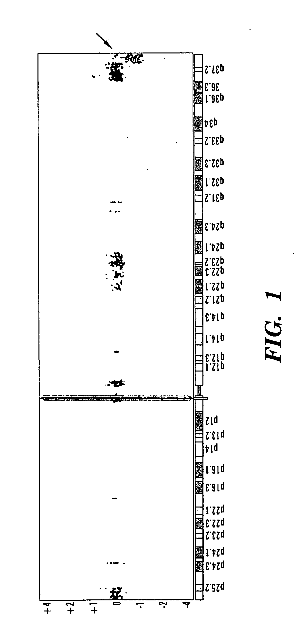 Method for diagnosing autism spectrum disorder