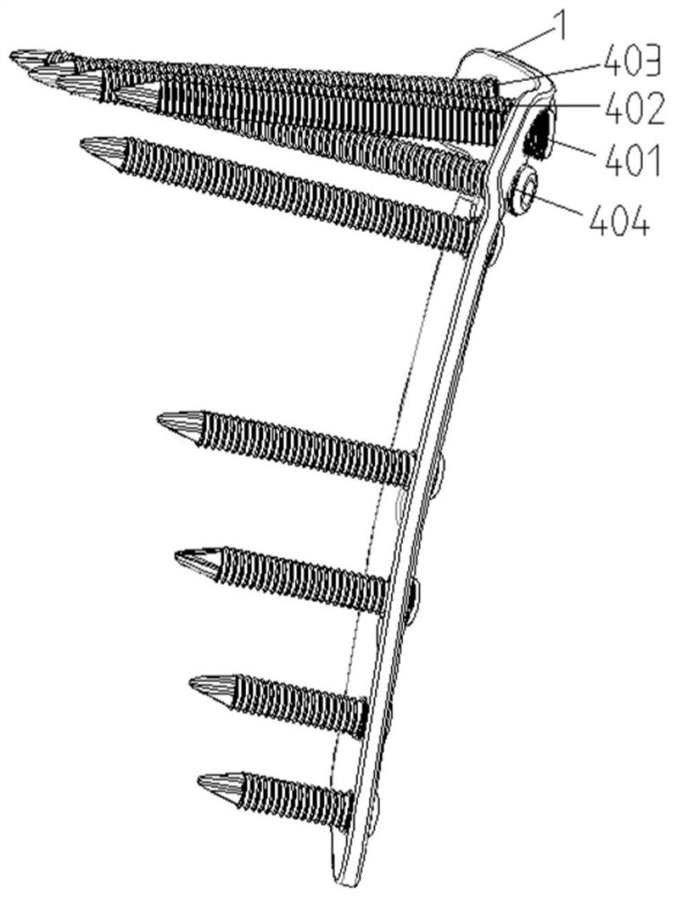 Special internal fixing device for proximal tibia joint osteotomy