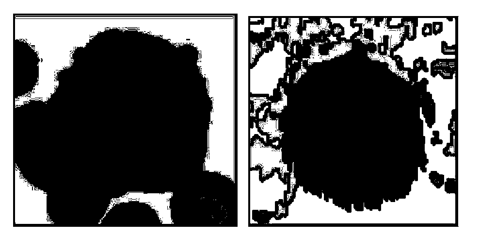 White blood cell image accurate segmentation method and system based on support vector machine