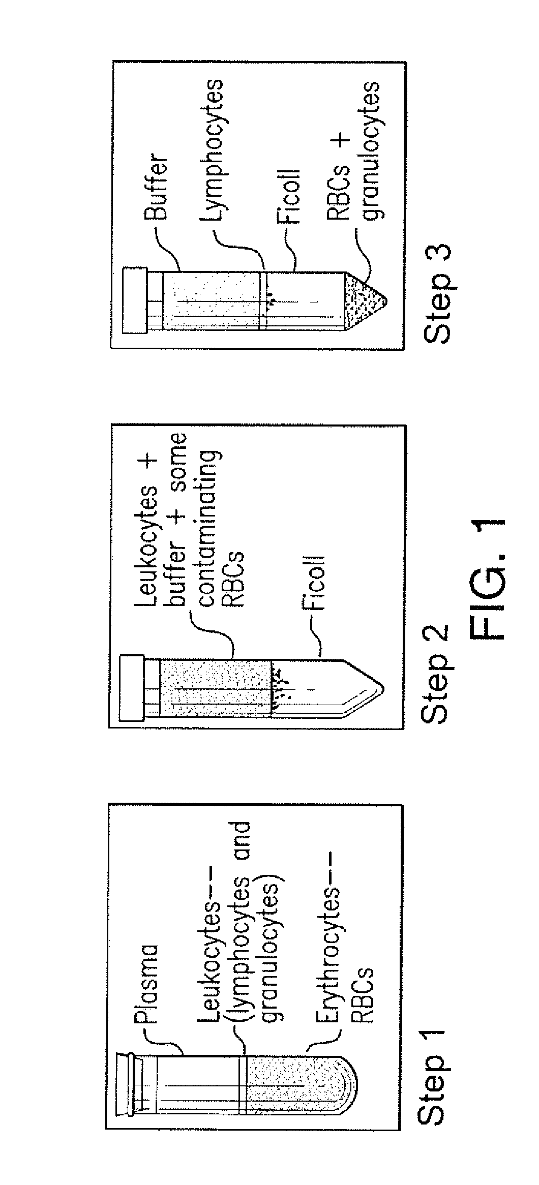 Method for diagnosing pompe disease