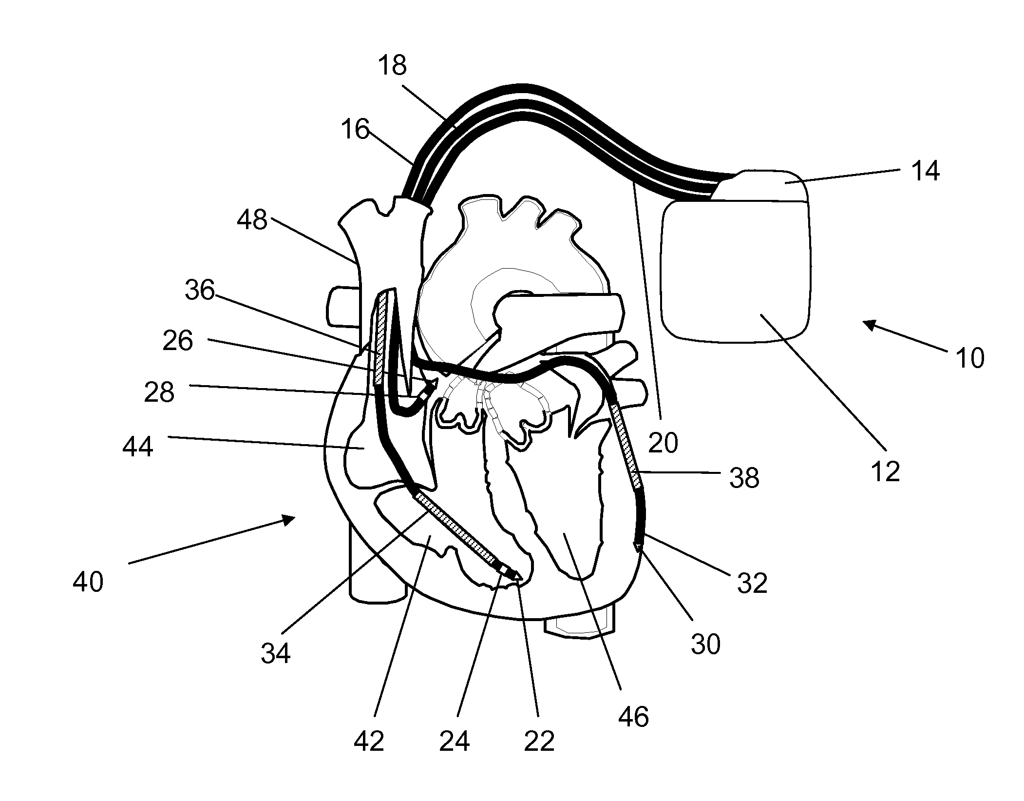 Heart monitor