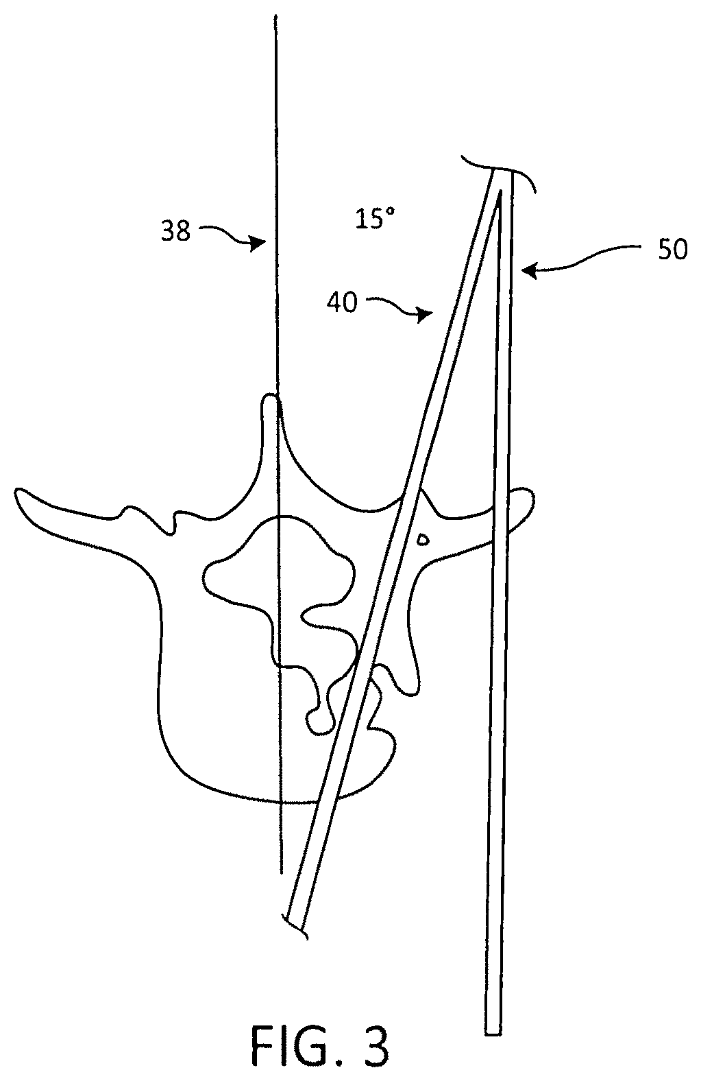 Surgical targeting systems and methods