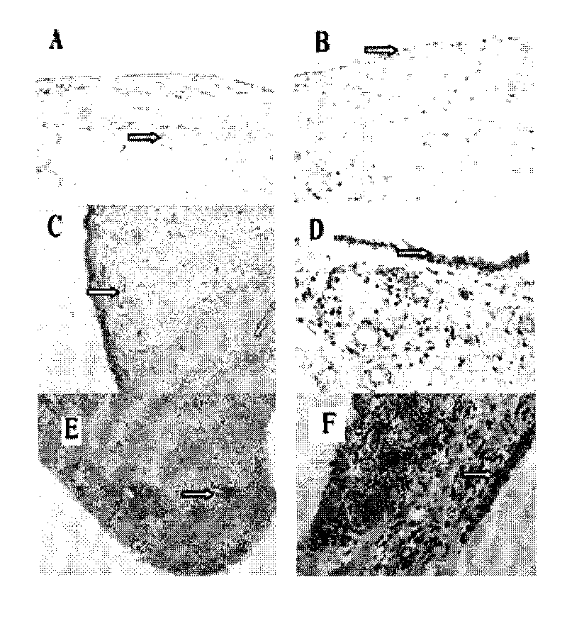 Monoclonal antibody (hybrid tumor) for neutralizing CYR61 and applications thereof