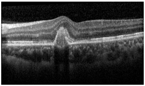 Robust interactive medical image segmentation method