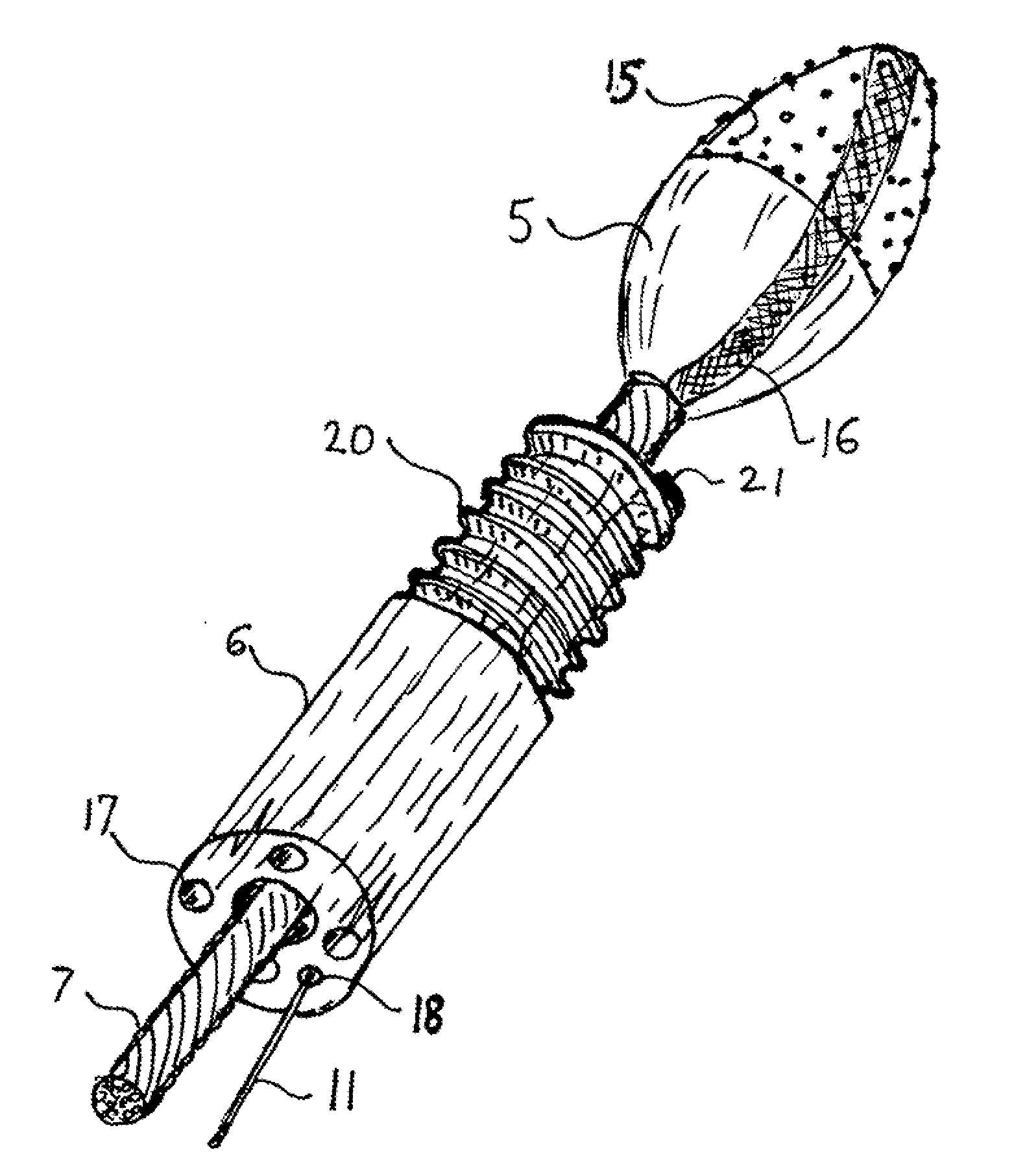 Automatic atherectomy system