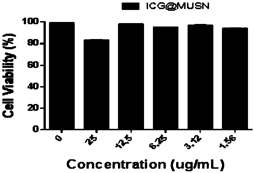 Preparation method for upconversionnanoparticles wrapped by mesoporous silica loading indocyanine green