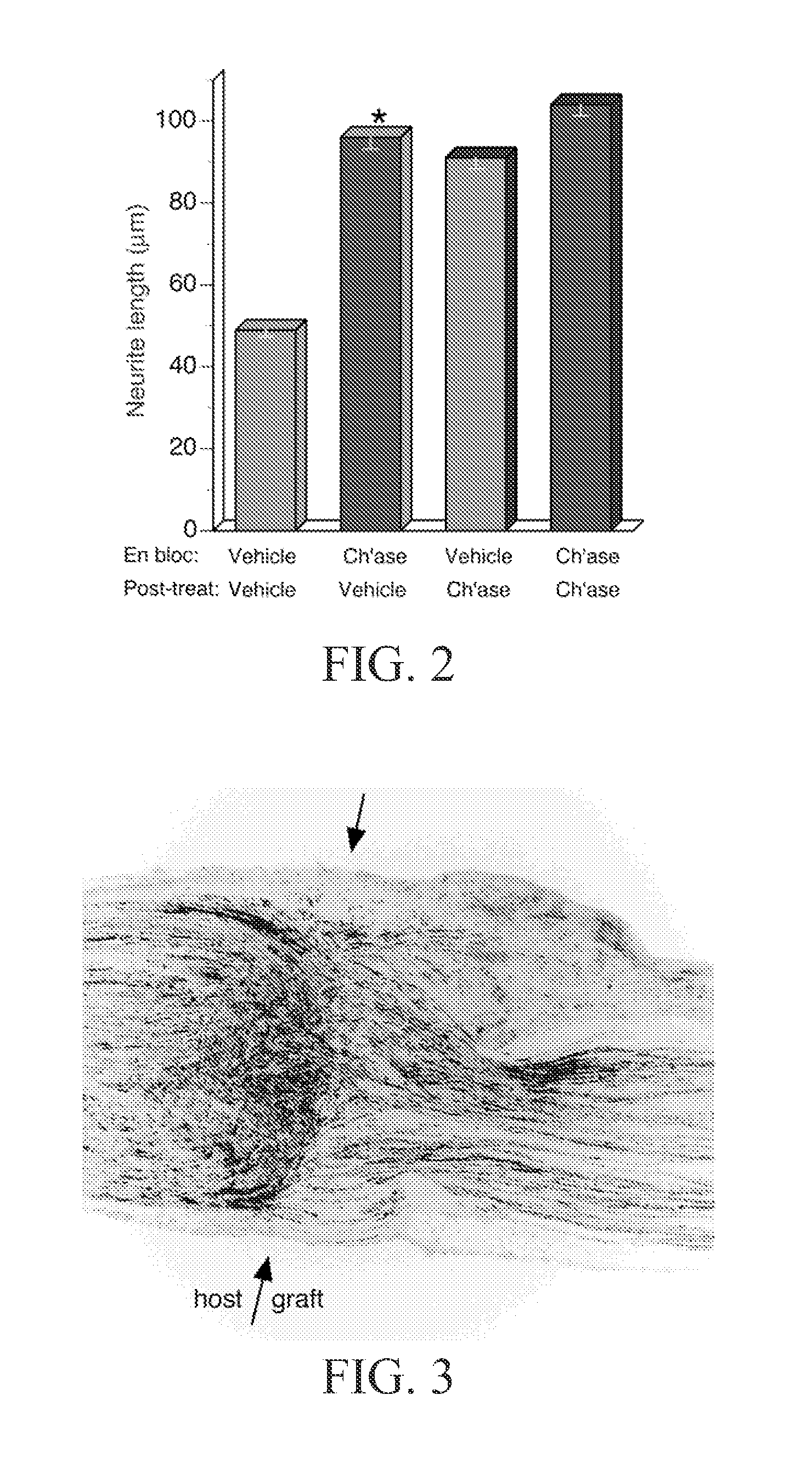 Material and Methods for Nerve Grafting