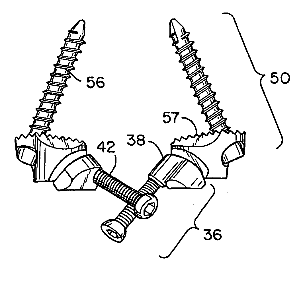 Prostheses, tools and methods for replacement of natural facet joints with artificial facet joint surfaces