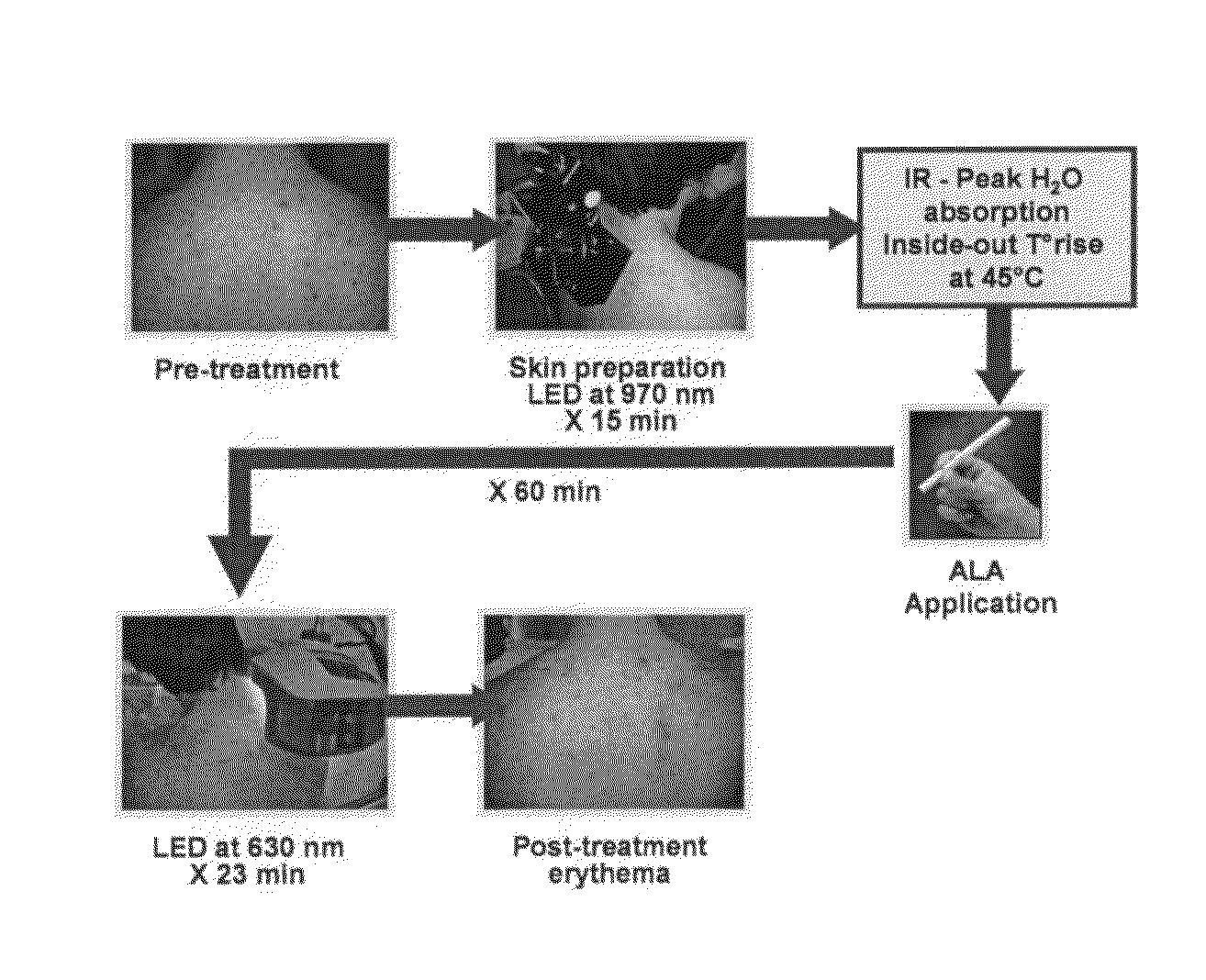 Radiant near infrared light emitting diode exposure as skin preparation