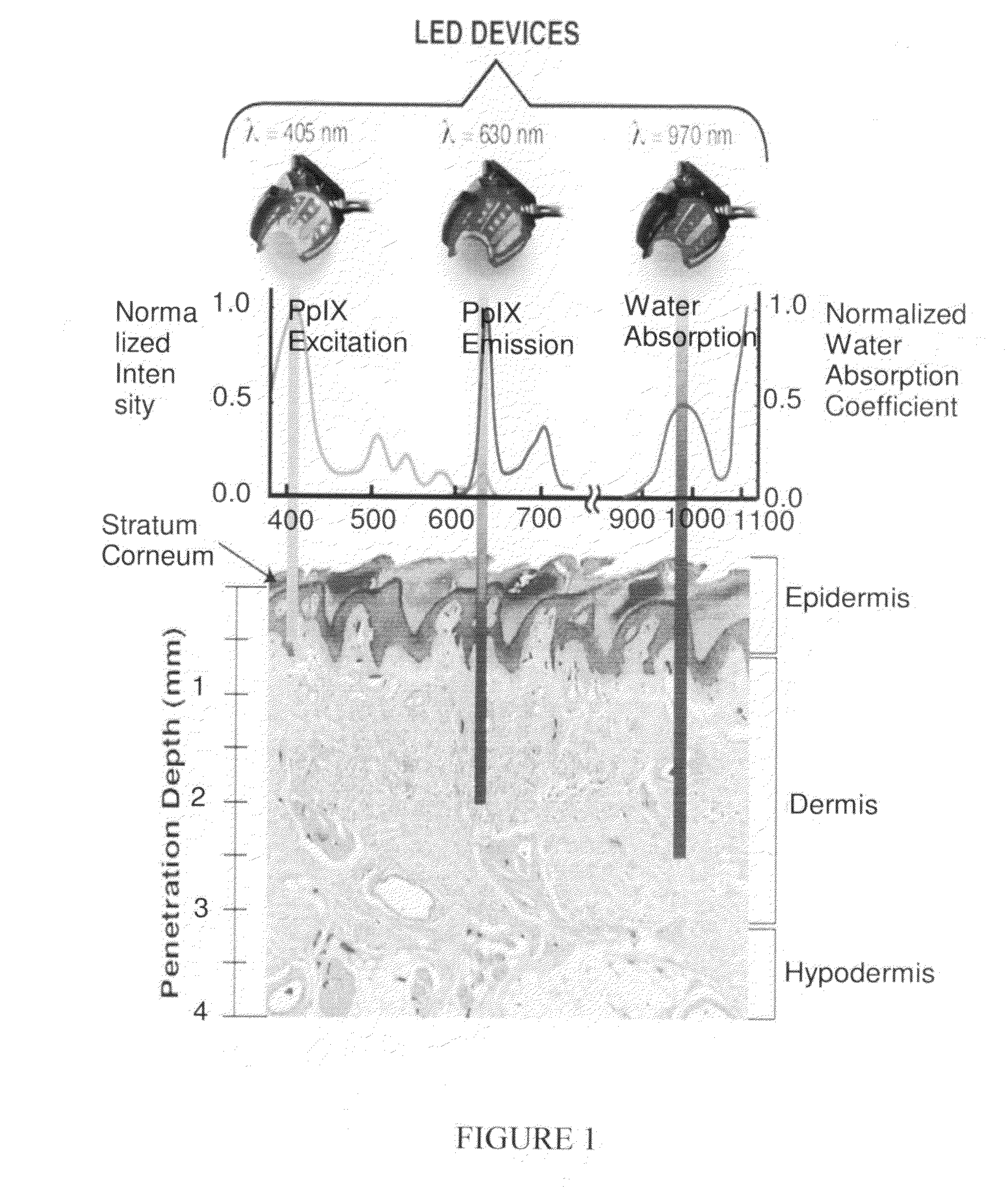 Radiant near infrared light emitting diode exposure as skin preparation