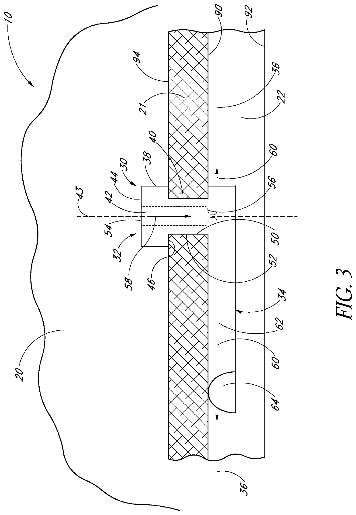 Glaucoma stent and methods thereof for glaucoma treatment