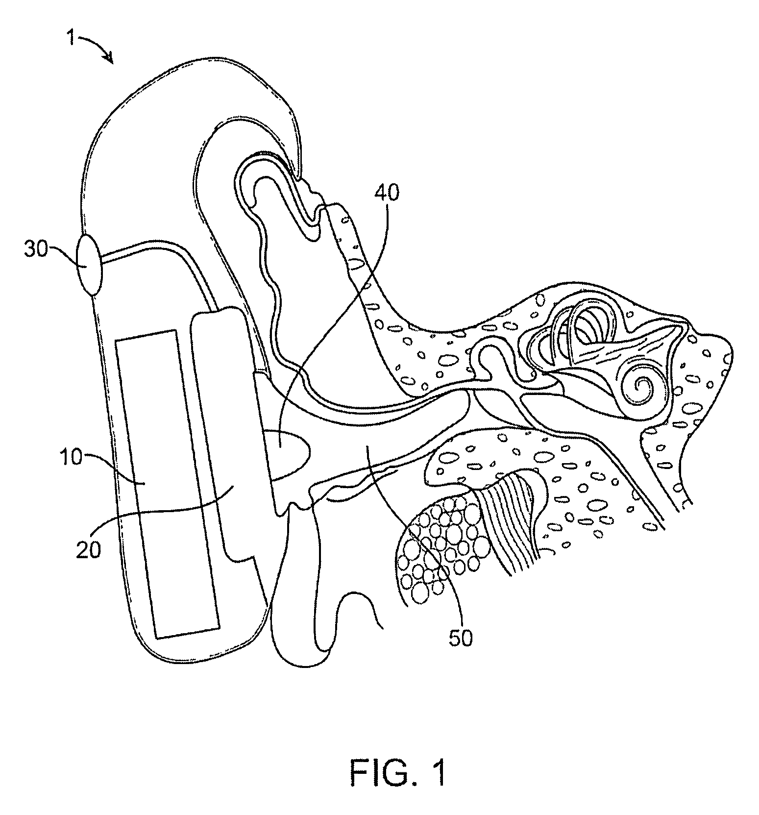 Optical ear infection treatment device and method