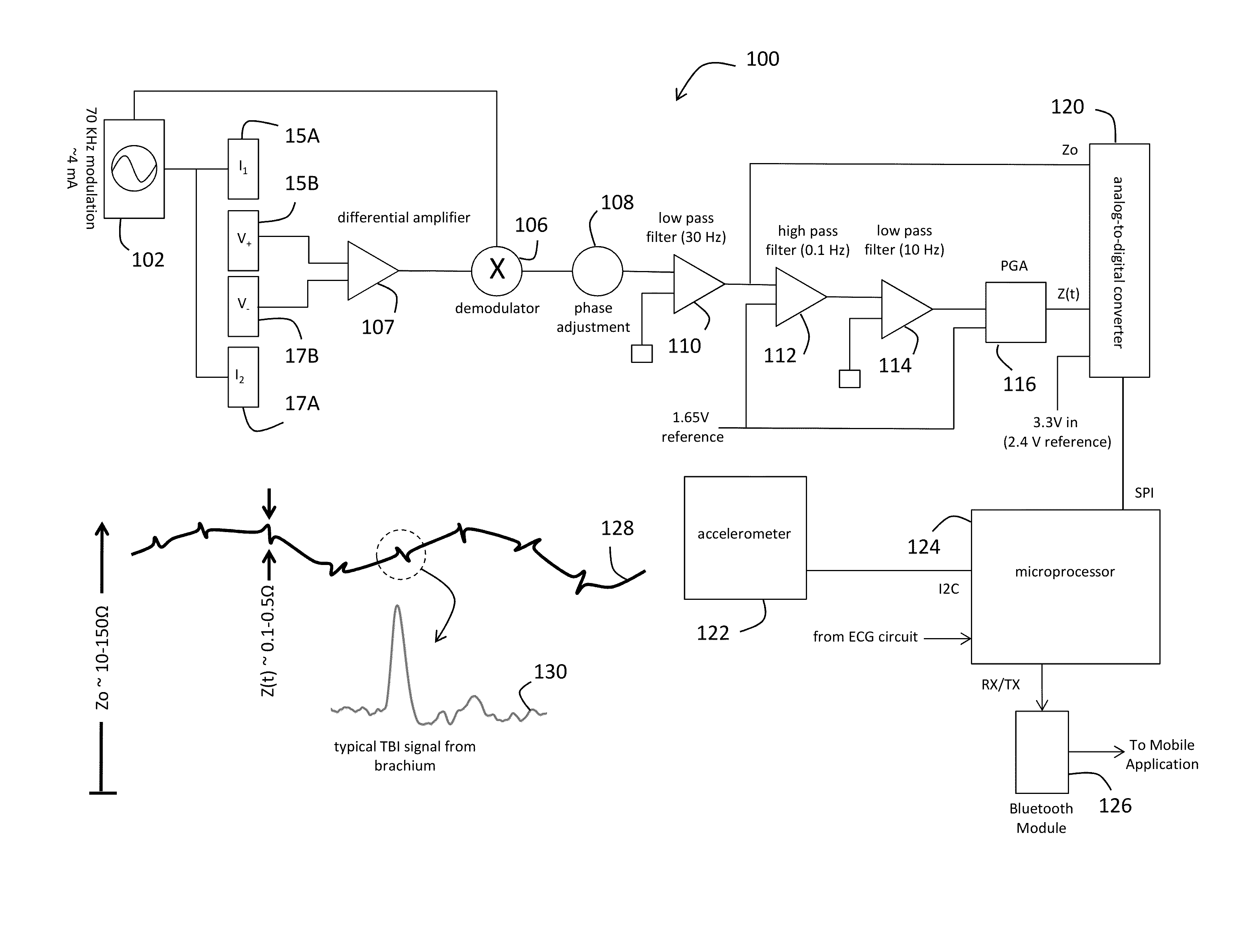 System for electrophysiology that includes software module and body-worn monitor