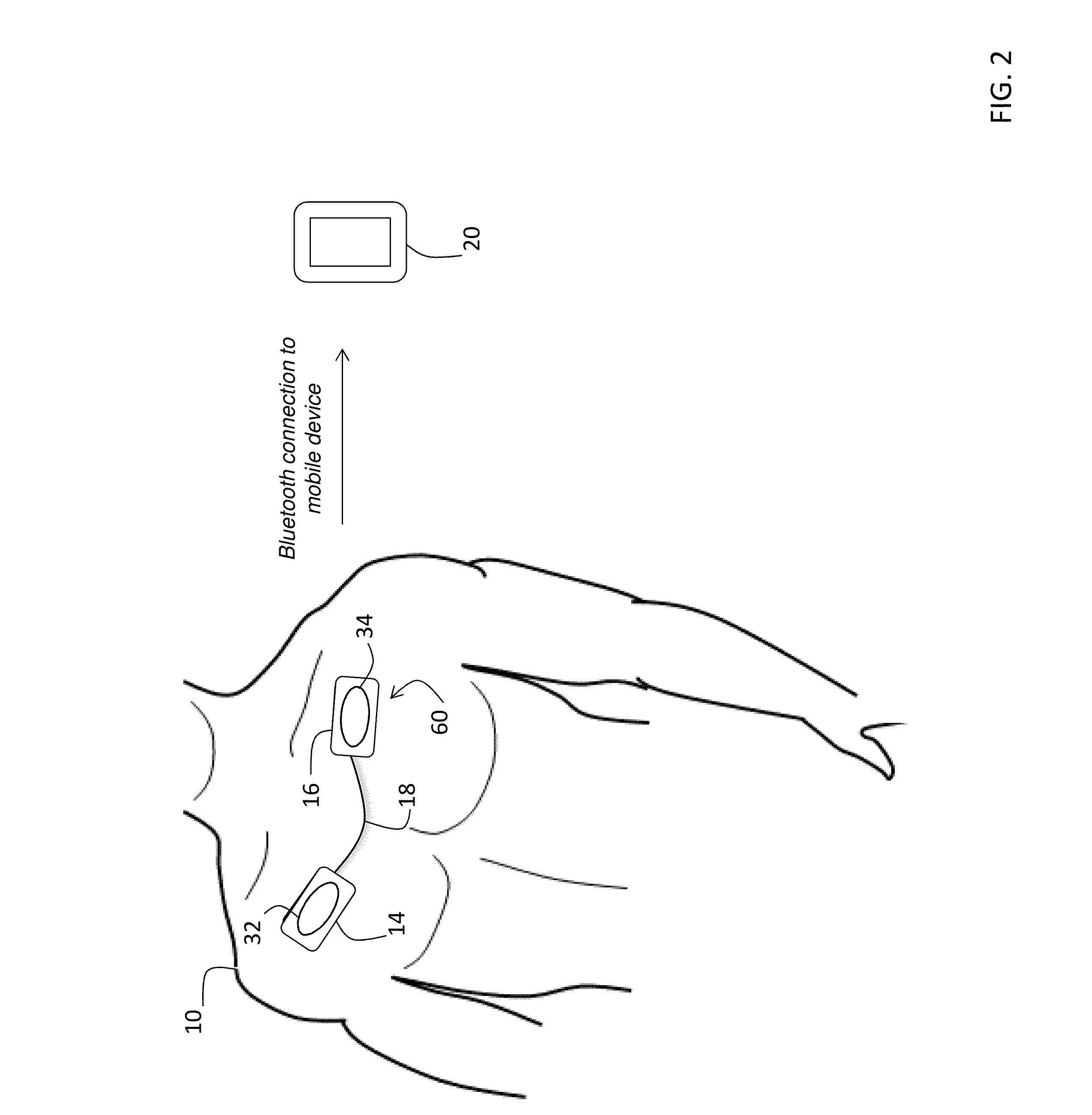 System for electrophysiology that includes software module and body-worn monitor