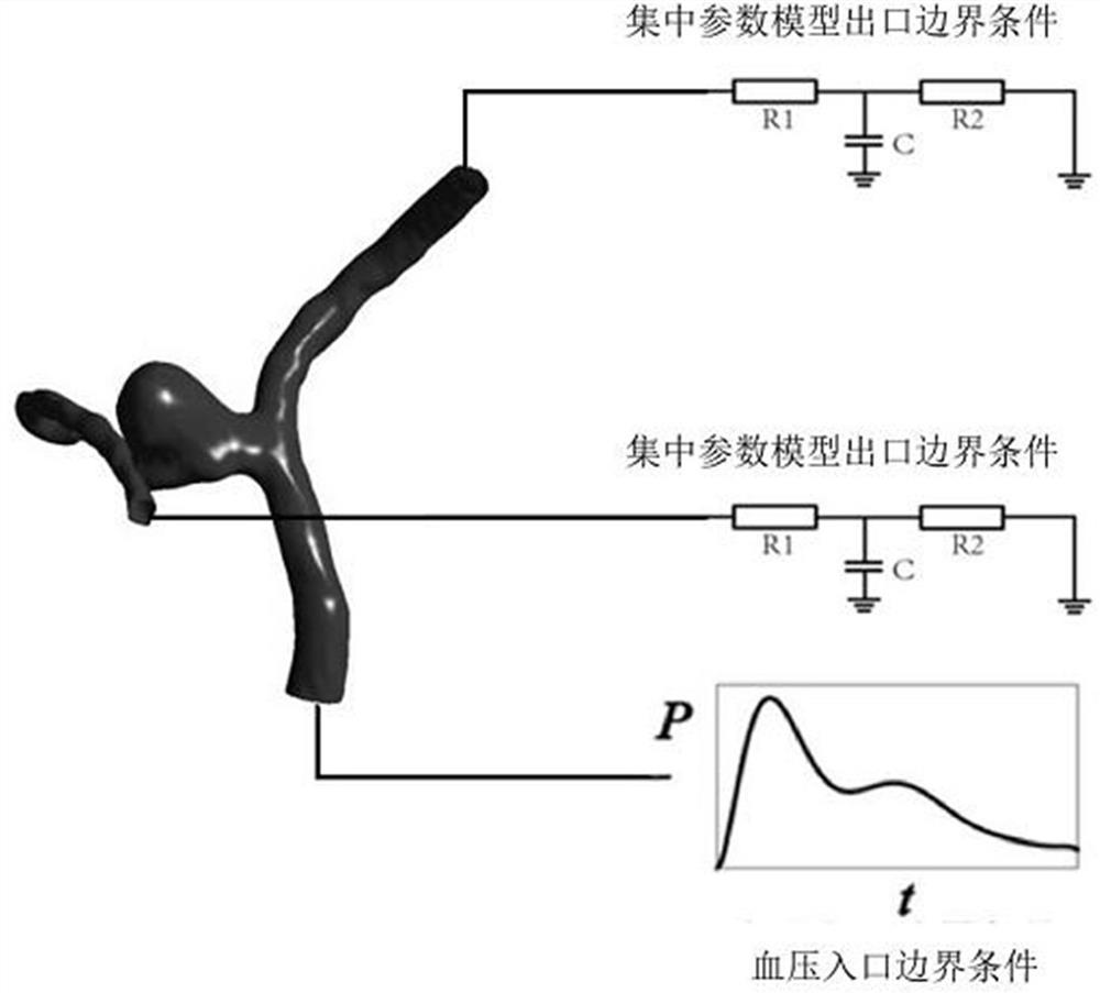 Hemodynamic index data processing method and system